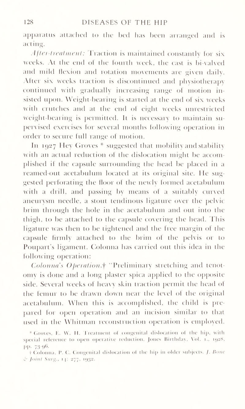 apparatus attached to the bed has been arranged and is act ing. A jlo-l real innil: Fraction is maintained constantly lot si\ weeks. At the end ol the lout lit week, the c ast is bi waived and mild flexion and rotation movements are given daily. Alter six weeks traction is discontinued and physiotherapy continued with gradually increasing range ol motion in¬ sisted upon. Weight-bearing is started at the end ol six weeks with clutches and at the end ol eight weeks unrestricted weight-bearing is permitted. It is necessary to maintain su¬ pervised exercises lor several months following operation in order to sec me lull range ol motion. In 11)27 Hey (doves # suggested that mobility and stability with an actual reduction ol the dislocation might be accom¬ plished il the capsule surrounding the head be placed in a reamed-out acetabulum located at its original site. He sug¬ gested perforating the door ol the newl\ formed acetabulum with a drill, and passing by means ol a suitable curved aneurysm needle, a stout tendinous ligature oxer the pelxic brim through the hole in the acetabulum and out into the thigh, to be attached to the capsule covering the head. I his ligature was then to be tightened and the free margin of the capsule (irmly attac hed to the brim ol the pel\ is or to Poupart’s ligament, (olonna has carried out this idea in the following operation: Colon mi's O j>c) til ion .f “Preliminary stretching and tenot¬ omy is done and a long plaster spica applied to the opposite side. Several weeks ol heaxy skin traction permit the head ol the femur to be drawn down neat the level ol the original acetabulum. When this is accomplished, the child is pie- pared for open operation and an incision similar to that used in the Whitman reconstruction operation is employed. * (.roves, I \\ . II. I reauncut ol congenital dislocation ol the hip, with special relcrc'iicc to open operative reduction, (ones Birlhdax, Xol. i., i«|irS. pp. 73-t)(i. I C,olonna. I'. C . Congenital dislocation ol the hip in oldei subjects. /. Hone C jnnil Sin^.. i p ^77.
