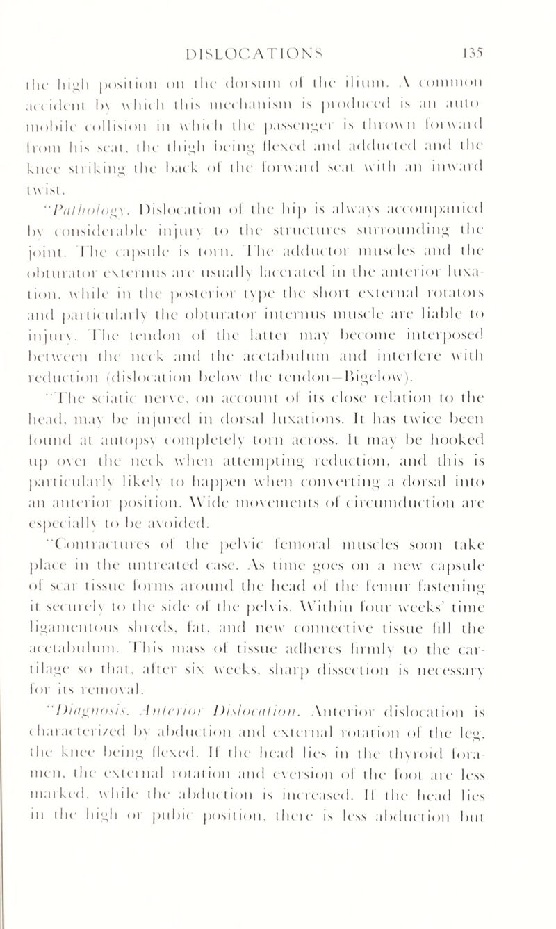 iIk' high position on the dorsum ol the- ilium. \ common .undent I>\ which iliis mechanism is produced is ;m .into mohile collision in which the passengei is thrown lorward from his scat, the illicit i»ein<>- Ile\ed and adducted and the knee striking the hack ol the lorward seal with an inward t wist. Pathology. Dislocation ol the hip is always accompanied |>\ considerable injurs to the- struct tires surroundin'*- the joint. I lie capsule is torn. I he adduc tot musc les and the obturatoi externus aic- usuallx lacerated in the anterior luxa¬ tion. while in the- posterioi tvpe the short external rotators and part ic ularlx the obturator interims musc le are liable to injurs. I lie tendon ol the latlei max become interposed between the neck and the acetabulum and interlere with reduction (dislocation below the tendon bigclow). The sciatic nerve, on account ol its close relation to the head, max be injured in dorsal luxations. It has twice been I'nund at autopsx completely torn across. It may be hooked up over the neck when attempting reduction, and this is part ic ularlx likelx to happen when com ci ting a dorsal into an anterioi position. Wide movements ol'circumduction are espcc iallx to be axoided. Contractures ol the pel\ ic lemoral musc les soon take place in the untreated case. As time goes on a new capsule ol scat tissue hums around the head ol the leniiu fastening it seen rely to the side ol the pelxis. Within lour weeks’ time ligamentous shreds, lat. and new connective tissue (ill the acetabulum. I bis mass ol tissue adheres lirmlx to the car¬ tilage- so that, altet six weeks, sharp dissection is necessarx lor its remoxal. Diagnosis. Interior Dislocation, \nterioi dislocation is c hai ac teri/ed In abduction and external rotation of the- leg, the knee being Hexed. II the head lies in the- thyroid lora men. the external rotation and excision ol the foot are less maiked. while the abduction is increased. II the head lies in the high 01 pubic position, there- is less abduction but