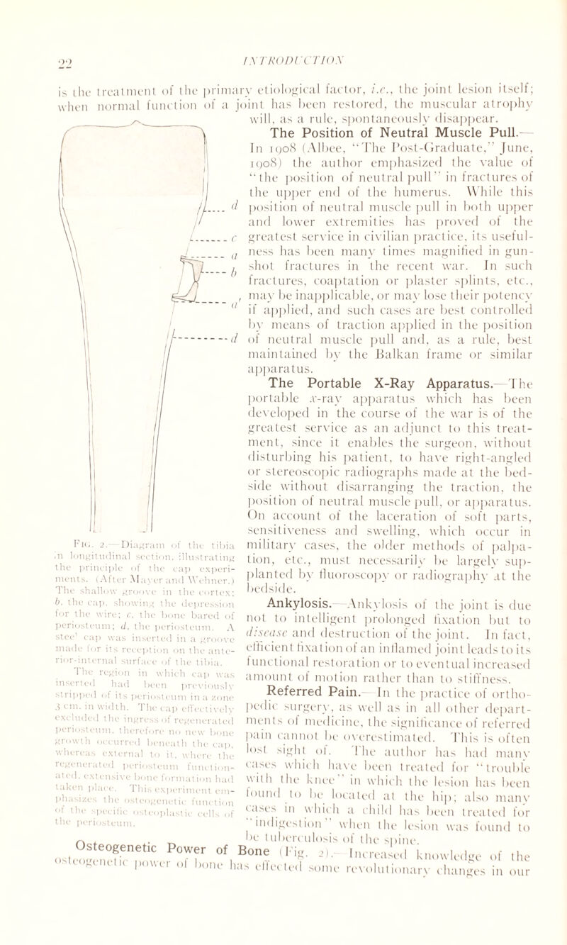 / NTRODl'CTIOX \\ d is the treatment of the primary etiological factor, i.e., the joint lesion itself; when normal function of a joint has been restored, the muscular atrophy will, as a rule, spontaneously disappear. The Position of Neutral Muscle Pull.— In 1908 (Albee, “The Post-Graduate,” June, 1908) the author emphasized the value of “the position of neutral pull” in fractures of the upper end of the humerus. While this position of neutral muscle pull in both upper and lower extremities has proved of the greatest service in civilian practice, its useful¬ ness has been many times magnified in gun¬ shot fractures in the recent war. In such fractures, coaptation or plaster splints, etc., may be inapplicable, or may lose their potency if applied, and such cases are best controlled by means of traction applied in the position of neutral muscle pull and, as a rule, best maintained by the Balkan frame or similar apparatus. The Portable X-Ray Apparatus. The portable .v-ray apparatus which has been developed in the course of the war is of the greatest service as an adjunct to this treat¬ ment, since it enables the surgeon, without disturbing his patient, to have right-angled or stereoscopic radiographs made at the bed¬ side without disarranging the traction, the position of neutral muscle pull, or apparatus. On account of the laceration of soft parts, sensitiveness and swelling, which occur in military cases, the older methods of pallia¬ tion, etc., must necessarily be largelv sup¬ planted by fluoroscopy or radiography at the bedside. Ankylosis. Ankylosis of the joint is due not to intelligent prolonged fixation but to disease and destruction of the joint. In fact, efficient fixation of an inflamed joint leads to it> functional restoration or to eventual increased amount of motion rather than to stiffness. Referred Pain. In the practice of ortho¬ pedic surgery, as well as in all other depart¬ ments ol medicine, the significance of referred pain cannot be overestimated. This is often lost sight of. The author has had main' cases which have been treated for “trouble nilli Ilu‘ knee in which the lesion has been found to be located at the hip; also many cases in which a child has been treated for “indigestion when the lesion was found ^ , . be tuberculosis of the Osteogenetic Power of Bone (Fig. 2).- osteogenetic power of bone has effected tig. 2. — Diagram of tin- tibia in longitudinal section, illustrating the principle of the cap experi¬ ment 5. (After Mayer and Wehner.) The shallow groove in the cortex; b. the cap. showing the depression for the wire; c. the bone bared of periosteum; d, the periosteum. A stec! cap was inserted in a groove made lor its reception on the ante¬ rior-internal surface of the tibia. 1 he region in which cap was inserted had been previously stripped of its periosteum in a zone 3 cm. in width. The cap effectively excluded the ingress of regenerated periosteum, therefore no new ' growth occurred beneath tin whereas external to it, where the regenerated periosteum function¬ ated, extensive bone formation had taken place. This experiment em¬ phasizes the osteogenetic function ol the specific osteoplastic cells of periosteum. in me iap, the to some lesion spine. Increased knowledge of the revoluIionarv changes in our