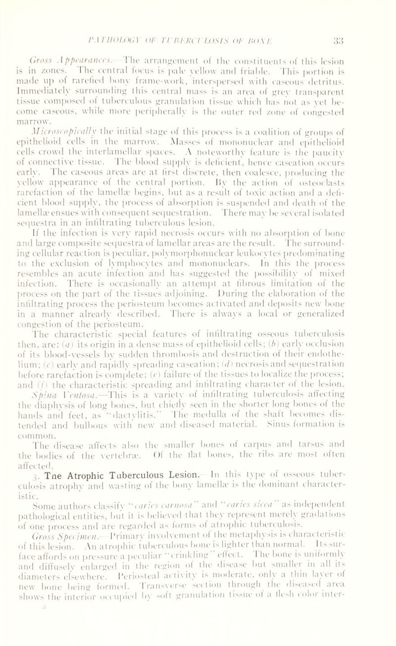 Gross Appearances. The arrangement of the constituent of this lesion is in zones. 1 he central locus is pale vellow and triable. I his portion is made up of rarefied bony frame-work, interspersed with caseous detritus. Immediately surrounding this central mass is an area ol grey transparent tissue composed of tuberculous granulation tissue which has not as yet be¬ come caseous, while more peripherally is the outer red zone of congested marrow. .1/icroscopically the initial stage of this process is a coalition of groups of epithelioid cells in the marrow. Masses ol mononuclear and epithelioid cells crowd the interlamellar spaces. A noteworthy feature is the paucitv of connective tissue. The blood supply is deficient, hence caseation occurs early. 1 he caseous areas are at lirst discrete, then coalesce, producing the yellow appearance of the central portion. By the action of osteoclasts rarefaction of the lamella? begins, but as a result of toxic action and a defi¬ cient blood supply, the process of absorption is suspended and death of the lamella? ensues with consequent sequestration. There may be several isolated sequestra in an infiltrating tuberculous lesion. If the infection is very rapid necrosis occurs with no absorption of bone and large composite sequestra of lamellar areas are the result. The surround¬ ing cellular reaction is peculiar, polymorphonuclear leukocytes predominating to the exclusion of lymphocytes and mononuclears. In this the process resembles an acute infection and has suggested the possibility of mixed infection. There is occasionally an attempt at fibrous limitation of the process on the part of the tissues adjoining. During the elaboration of the infiltrating process the periosteum becomes activated and deposits new bone in a manner already described. There is always a local or generalized congestion of the periosteum. The characteristic special features of infiltrating osseous tuberculosis then, are: (a) its origin in a dense mass of epithelioid cells; (b) early occlusion of its blood-vessels bv sudden thrombosis and destruction of their endothe¬ lium; (c) earlv and rapidlv spreading caseation; (d) necrosis and sequestration before rarefaction is complete; (c) tailure of the tissues to localize the process; and (f) the characteristic spreading and infiltrating character of the lesion. Spina Vcntosa.—This is a variety of infiltrating tuberculosis affecting the diaphysis of long bones, but chiefly seen in the shorter long bones ol the hands and feet, as “ dactvlitis. 'The medulla of the shaft becomes dis¬ tended and bulbous with new and diseased material. Sinus lormation is common. 'The disease affects also the smaller bones of carpus and tarsus and the bodies of the vertebra1. Of the fiat bones, the ribs are most often affected. p Tne Atrophic Tuberculous Lesion. In this type of osseous tuber¬ culosis atrophy and wasting of the bony lamella1 is the dominant character¬ istic. Some authors classifv “canes carnosa and caries sicca a> independent pathological entities, but it is believed that they represent merely gradations of one process and are regarded as forms of atrophic tuberculosis. Gross Specimen. I’rimarv involvement ol I he melaphysis is charai leristu of this lesion. An atrophic tuberculous bone is lighter than normal. I ts sur¬ face affords on pressure a peculiar “crinkling elfect. I he bone is uniloimh and diffuselv enlarged in the region ol the disease but smallet in all it diameters elsewhere. Periosteal activity is modeiale, onl\ a thin la\et <>1 new bone being formed. Transverse section through the diseased area shows the interior occupied by soli granulation tissue ol .1 fiesh 10I01 inlet-
