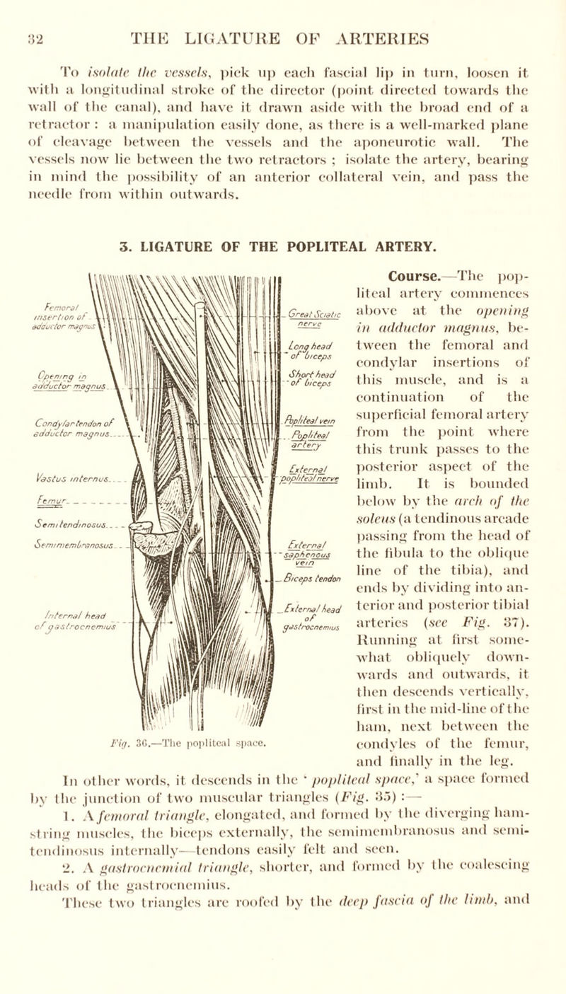 To isolate the vessels, pick up each fascial lip in turn, loosen it with a longitudinal stroke of the director (point directed towards the wall of the canal), and have it drawn aside with the broad end of a retractor : a manipulation easily done, as there is a well-marked plane of cleavage between the vessels and the aponeurotic wall. The vessels now lie between the two retractors ; isolate the artery, bearing in mind the possibility of an anterior collateral vein, and pass the needle from within outwards. 3. LIGATURE OF THE POPLITEAL ARTERY. Great Sciatic Long head  of biceps Short head 'of biceps fbp/tea/ vein .. Pop/deaf artery Course.—The pop¬ liteal artery commences above at the opening in adductor magnus, be¬ tween the femoral and condylar insertions of this muscle, and is a continuation of the superficial femoral artery from the point where this trunk passes to the posterior aspect of the limb. It is bounded below by the arch of the soleus (a tendinous arcade passing from the head of the fibula to the oblique line of the tibia), and ends by dividing into an¬ terior and posterior tibial arteries (see Fig. 37). Running at first some¬ what obliquely down¬ wards and outwards, it then descends vertically, first in the mid-line of the ham, next between the condyles of the femur, and finally in the leg. In other words, it descends in the * popliteal space,' a space formed by the junction of two muscular triangles (Fig. 35) :— 1. A femoral triangle, elongated, and formed by the diverging ham¬ string muscles, the biceps externally, I he semimembranosus and semi- tendinosus internally—tendons easily felt and seen. 2. A gastrocncmial triangle, shorter, and formed by the coalescing heads of the gastrocnemius. These two triangles are roofed by the deep fascia oj the lunh, and Femora/ insertion of adductor magnus Opening in adductor magnus Con dy far tendon of adductor magnus Vastus intern us_ Femur_ Semi tend/nosus_- Semimembranosus. . Interna! head ofgastrocnemius Externa/ popliteal nerve External ' ~saphenous vem _ Biceps tendon .Externa/ head of gas trocnermus Fig. 3G.—The popliteal space.