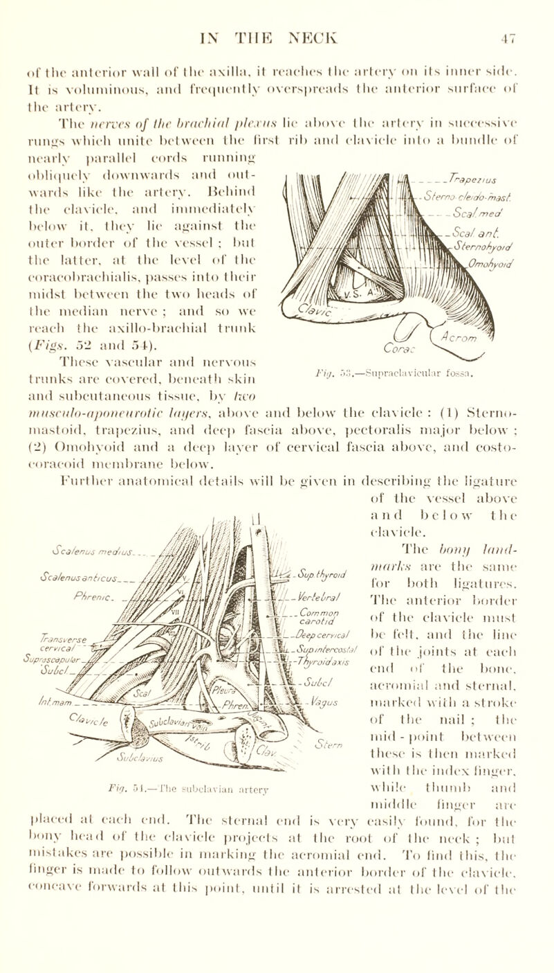 of the anterior wall of the axilla, it reaches the artery on its inner side. It is voluminous, and frequently overspreads the anterior surface of the artery. The nerves of the brachial plexus lie above the artery in successive rungs which unite between the first rib and clavicle into a bundle of nearly parallel cords running obliquely downwards and out¬ wards like the artery. liehind the clavicle, and immediately below it. they lie against the outer border of the vessel : but the latter, at the level of the coraeobraehialis, passes into their midst between the two heads of the median nerve; and so we reach the axillo-braehial trunk (Figs. 52 and 54). These vascular and nervous trunks are covered, beneath skin and subcutaneous tissue, by hvo wusculo-aponeurolic tapers, above and below the clavicle: (1) Sterno- mastoid, trapezius, and deep fascia above, pectoralis major below ; (2) Omohyoid and a deep layer of cervical fascia above, and costo- eoraeoid membrane below. Further anatomical details will be given in describing the ligature of the vessel above a n d b c 1 o w t h e clavicle. The boni) Jan el- in arks are the same for both ligatures. The anterior border of the clavicle must be felt, and the line of the joints at each end of the bone, acromial and sternal, marked with a stroke of the nail ; the mid - point between these is then marked wil h I he index linger, while thumb and middle finger are placed at each end. 'flic sternal end is very easily found, for the bony head of the clavicle projects at the root of the neck ; but mistakes are possible in marking the acromial end. To find this, the linger is made to follow outwards the anterior border of the clavicle, concave forwards at this point, until it is arrested at the level of the Scà/emjs Sca/enus an ê/eus. Phrente. Transverse cervical Suprjsctjpu/dr Sulci. _ Sup thyroid -- J- - Vertebra/ fà Com mon t carotid L -Deep cervical _ H/i. _ Sup intercostal - -Thyroidaxis Ste Fi(i. 51.—The subclavian artery