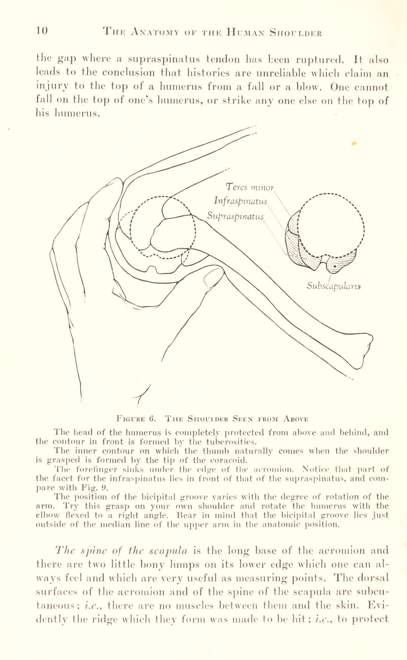 the gap where a supraspinatus tendon has been ruptured. It also leads to the conclusion that histories are unreliable which claim an injury to the top of a humerus from a fall or a blow. One cannot fall on the top of one’s humerus, or strike any one else on the top of his humerus. Figure 6. Tiie Siioui.dek Seen from Above The head of the humerus is completely protected from above and behind, and the contour in front is formed by the tuberosities. The inner contour on which the thumb naturally comes when the shoulder is grasped is formed by tbe tip of the coracoid. The forefinger sinks under the edge of the acromion. Notice that part of the facet for the infraspinatus lies in front of that of the supraspinatus, and com¬ pare with Fig. 9. The position of the bicipital groove varies with the degree of rotation of the arm. Try this grasp on your own shoulder and rotate the humerus with the elbow flexed to a right angle. Hear in mind that the bicipital groove lies just outside of the median line of the upper arm in the anatomic position. The spine of the scapula is the long base of the acromion and there are two little bony lumps on its lower edge which one can al¬ ways feel and which are very useful as measuring points. The dorsal surfaces of the acromion and of the spine of the scapula are subcu¬ taneous; i.e., there are no muscles between them and the skin. Evi¬ dently the ridge which they form was made to be hit; i.e., to protect