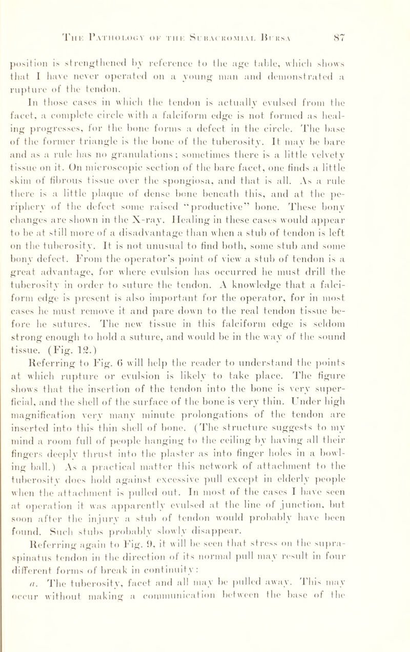 position is strengthened by reference to the age table, which shows that I have never operated on a young man and demonstrated a rupture of the tendon. In those eases in which the tendon is actually evulsed from the facet, a complete circle with a falciform edge is not formed as heal¬ ing progresses, for the bone forms a defect in the circle. The base of the former triangle is the bone of the tuberositv. It mav be bare and as a rule has no granulations; sometimes there is a little velvety tissue on it. On microscopic section of the bare facet, one finds a little shim of fibrous tissue over the spongiosa, and that is all. As a rule there is a little plaque of dense bone beneath this, and at the pe¬ riphery of the defect some raised *4productive” bone. These bony changes are shown in the X-ray. Healing in these cases would appear to he at >till more of a disadvantage than when a stub of tendon is left on the tuberosity. It is not unusual to find both, some stub and some bony defect. From the operator's point of view a stub of tendon is a great advantage, for where evulsion has occurred he must drill the tuberosity in order to suture the tendon. A knowledge that a falci¬ form edge is present is also important for the operator, for in most cases he must remove it and pare down to the real tendon tissue be¬ fore he sutures. The new tissue in this falciform edge is seldom strong enough to hold a suture, and would be in the way of the sound tissue. (Fig. 12.) Referring to Fig. (5 will help the reader to understand the points at which rupture or evulsion is likely to take place. The figure shows that the insertion of the tendon into the bone is very super¬ ficial. and the shell of the surface of the bone is very thin. Under high magnification very many minute prolongations of the tendon are inserted into this thin shell of bone. (The structure suggests to my mind a room full of people hanging to the ceiling by having all their fingers deeply thrust into the plaster as into finger holes in a bowl¬ ing ball.) As a practical matter this network of attachment to the tuberositv does hold against excessive pull except in elderly people when the attachment is pulled out. In most, of the cases I have seen at operation it was apparently evulsed at the line of junction, but soon after the injure a stub of tendon would probably have been found. Such stubs probably slowly disappear. Referring again to Fig. 0, it will be seen that stress on the supra- spinatus tendon in the direction of its normal pull may result m four different forms of break in continuity: a. The tuberosity, facet and all may be pulled away. This may occur without making a communication between the base of the