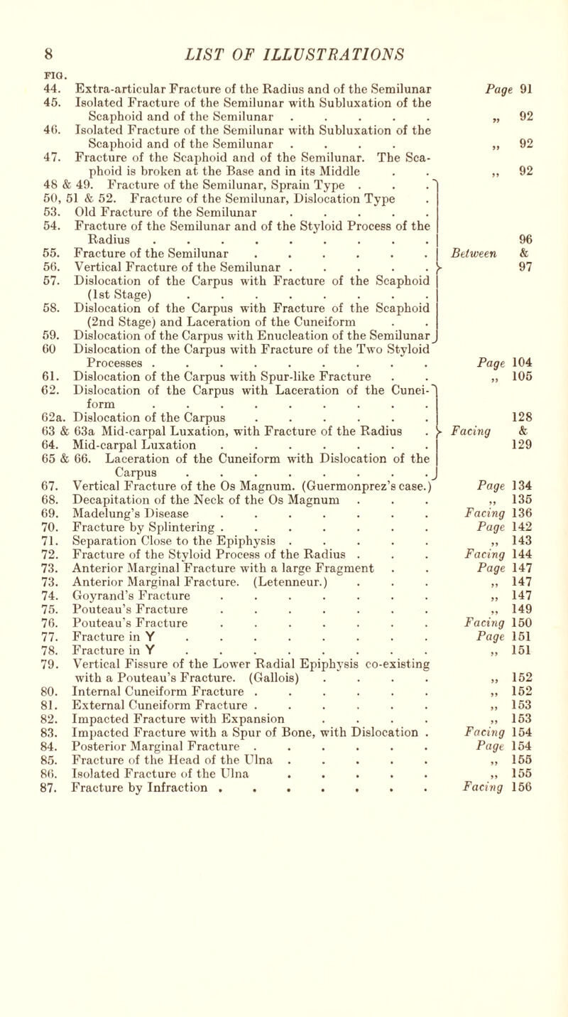 FIG 44. 45. Extra-articular Fracture of the Radius and of the Semilunar Isolated Fracture of the Semilunar with Subluxation of the Scaphoid and of the Semilunar ..... Isolated Fracture of the Semilunar with Subluxation of the Scaphoid and of the Semilunar .... Fracture of the Scaphoid and of the Semilunar. The Sca¬ phoid is broken at the Base and in its Middle 48 & 49. Fracture of the Semilunar, Sprain Type . 50, 51 & 52. Fracture of the Semilunar, Dislocation Type 53. Old Fracture of the Semilunar ..... Fracture of the Semilunar and of the Styloid Process of the Radius ......... Fracture of the Semilunar ...... Vertical Fracture of the Semilunar ..... Dislocation of the Carpus with Fracture of the Scaphoid (1st Stage) ........ Dislocation of the Carpus with Fracture of the Scaphoid (2nd Stage) and Laceration of the Cuneiform Dislocation of the Carpus with Enucleation of the Semilunar Dislocation of the Carpus with Fracture of the Two Styloid 40. 47. 54. 55. 56. 57. 58. 59. 60 Page 91 „ 92 „ 92 „ 92 Between 96 & 97 Processes ......... Page 104 61. Dislocation of the Carpus with Spur-like Fracture ft 105 62. 62a. Dislocation of the Carpus with Laceration of the Cunei-' form ......... Dislocation of the Carpus ...... 128 63 & 63a Mid-carpal Luxation, with Fracture of the Radius - Facing & 64. Mid-carpal Luxation ....... 129 65 & 66. Laceration of the Cuneiform with Dislocation of the Carpus 67. Vertical Fracture of the Os Magnum. (Guermonprez’scase.) Page 134 68. Decapitation of the Neck of the Os Magnum Madelung’s Disease ....... ft 135 69. Facing 136 70. Fracture by Splintering ....... Page 142 71. Separation Close to the Epiphysis ..... ft 143 72. Fracture of the Styloid Process of the Radius . Facing 144 73. Anterior Marginal Fracture with a large Fragment Page 147 73. Anterior Marginal Fracture. (Letenneur.) Goyrand’s Fracture ....... Pouteau’s Fracture ....... ft 147 74. ft 147 75. ft 149 76. Pouteau’s Fracture ....... Facing 150 77. Fracture in Y Page 151 78. Fracture in Y ft 151 79. Vertical Fissure of the Lower Radial Epiphysis co-existing with a Pouteau’s Fracture. (Gallois) .... ft 152 80. Internal Cuneiform Fracture ...... ft 152 81. External Cuneiform Fracture ...... ft 153 82. Impacted Fracture with Expansion .... ft 153 83. Impacted Fracture with a Spur of Bone, with Dislocation . Facing 154 84. Posterior Marginal Fracture ...... Page 154 85. Fracture of the Head of the Ulna ..... ft 155 86. Isolated Fracture of the Ulna ..... ft 155 87. Fracture by Infraction ....... Facing 156