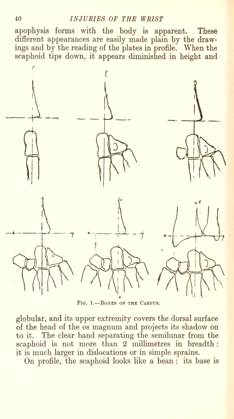 apophysis forms with the body is apparent. These different appearances are easily made plain by the draw¬ ings and by the reading of the plates in profile. When the scaphoid tips down, it appears diminished in height and globular, and its upper extremity covers the dorsal surface of the head of the os magnum and projects its shadow on to it. The clear band separating the semilunar from the scaphoid is not more than 2 millimetres in breadth : it is much larger in dislocations or in simple sprains. On profile, the scaphoid looks like a bean : its base is