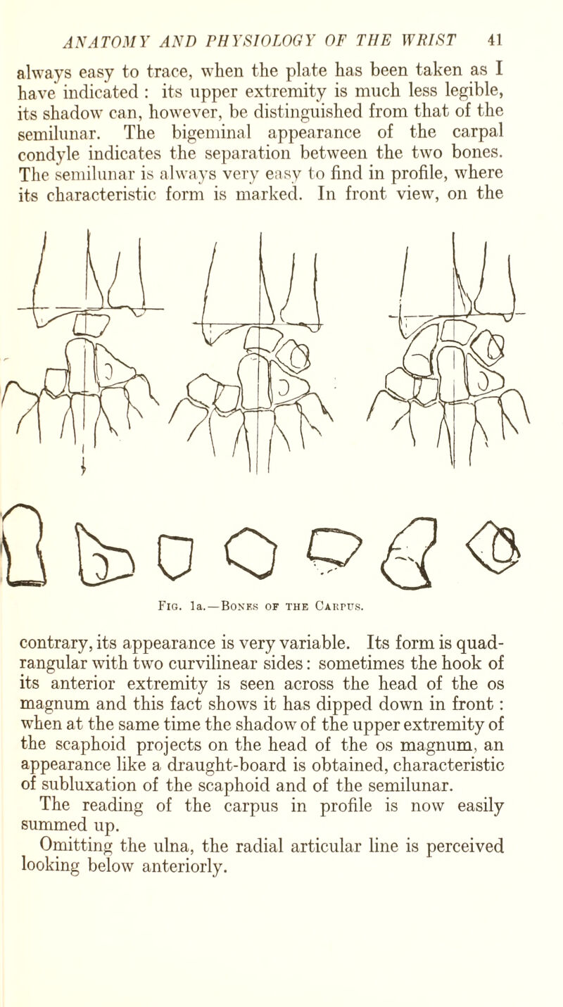 always easy to trace, when the plate has been taken as I have indicated : its upper extremity is much less legible, its shadow can, however, be distinguished from that of the semilunar. The bigeminal appearance of the carpal condyle indicates the separation between the two bones. The semilunar is always very easy to find in profile, where its characteristic form is marked. In front view, on the Fig. la.—Bones of the Caktus. contrary, its appearance is very variable. Its form is quad¬ rangular with two curvilinear sides: sometimes the hook of its anterior extremity is seen across the head of the os magnum and this fact shows it has dipped down in front: when at the same time the shadow of the upper extremity of the scaphoid projects on the head of the os magnum, an appearance like a draught-board is obtained, characteristic of subluxation of the scaphoid and of the semilunar. The reading of the carpus in profile is now easily summed up. Omitting the ulna, the radial articular line is perceived looking below anteriorly.