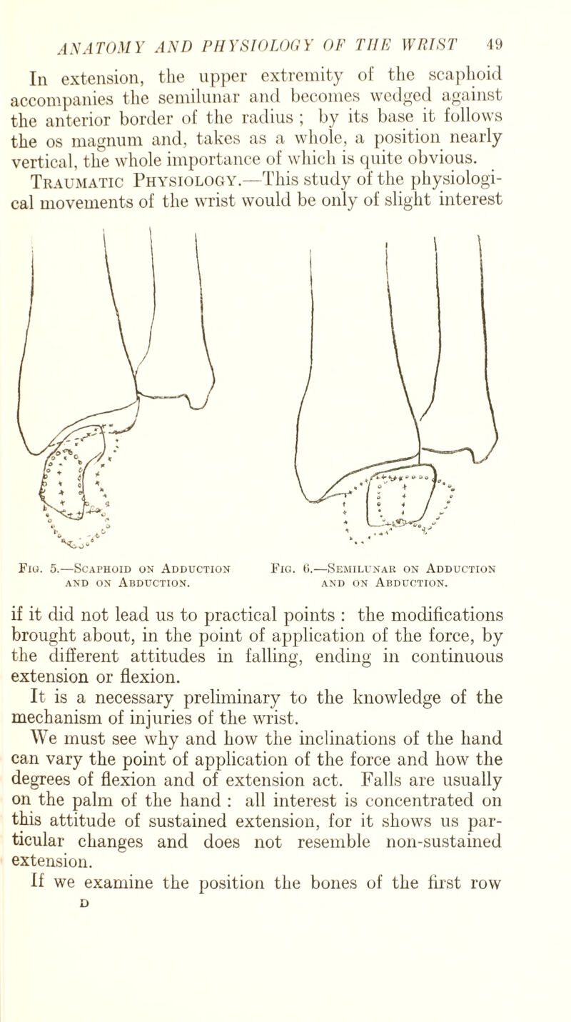 In extension, the upper extremity of the scaphoid accompanies the semilunar and becomes wedged against the anterior border of the radius ; by its base it follows the os magnum and, takes as a whole, a position nearly vertical, the whole importance of which is quite obvious. Traumatic Physiology.—This study of the physiologi¬ cal movements of the wrist would be only of slight interest Fig. 5.—Scaphoid on Adduction Fig. 6.—Semilunar on Adduction and on Abduction. and on Abduction. if it did not lead us to practical points : the modifications brought about, in the point of application of the force, by the different attitudes in falling, ending in continuous extension or flexion. It is a necessary preliminary to the knowledge of the mechanism of injuries of the wrist. We must see why and how the inclinations of the hand can vary the point of application of the force and how the degrees of flexion and of extension act. Falls are usually on the palm of the hand : all interest is concentrated on this attitude of sustained extension, for it shows us par¬ ticular changes and does not resemble non-sustained extension. If we examine the position the bones of the first row