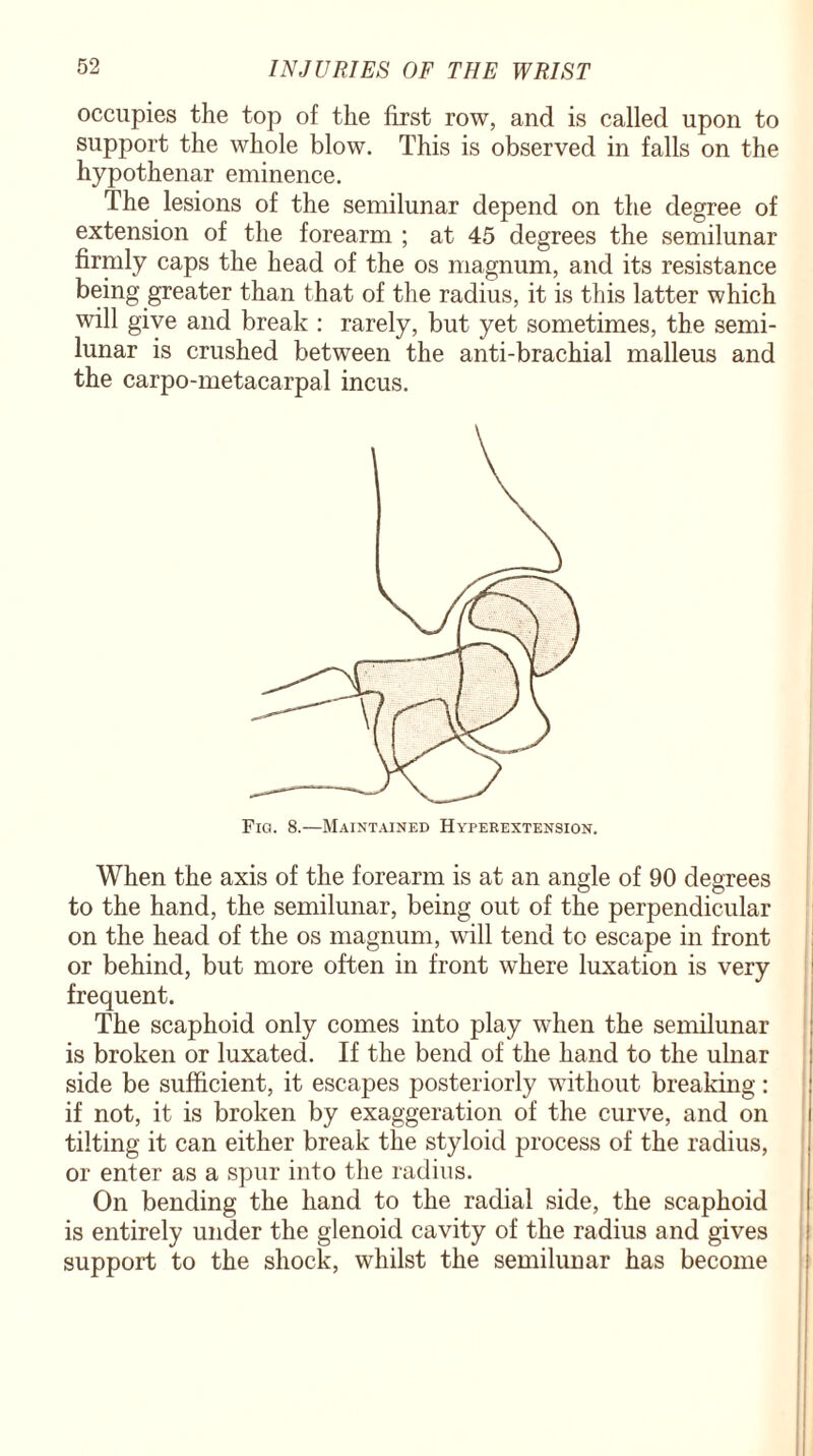 occupies the top of the first row, and is called upon to support the whole blow. This is observed in falls on the hypothenar eminence. The lesions of the semilunar depend on the degree of extension of the forearm ; at 45 degrees the semilunar firmly caps the head of the os magnum, and its resistance being greater than that of the radius, it is this latter which will give and break : rarely, but yet sometimes, the semi¬ lunar is crushed between the anti-brachial malleus and the carpo-metacarpal incus. Fig. 8.—Maintained Hyperextension. When the axis of the forearm is at an angle of 90 degrees to the hand, the semilunar, being out of the perpendicular on the head of the os magnum, will tend to escape in front or behind, but more often in front where luxation is very frequent. The scaphoid only comes into play when the semilunar is broken or luxated. If the bend of the hand to the ulnar side be sufficient, it escapes posteriorly without breaking: if not, it is broken by exaggeration of the curve, and on tilting it can either break the styloid process of the radius, or enter as a spur into the radius. On bending the hand to the radial side, the scaphoid is entirely under the glenoid cavity of the radius and gives support to the shock, whilst the semilunar has become