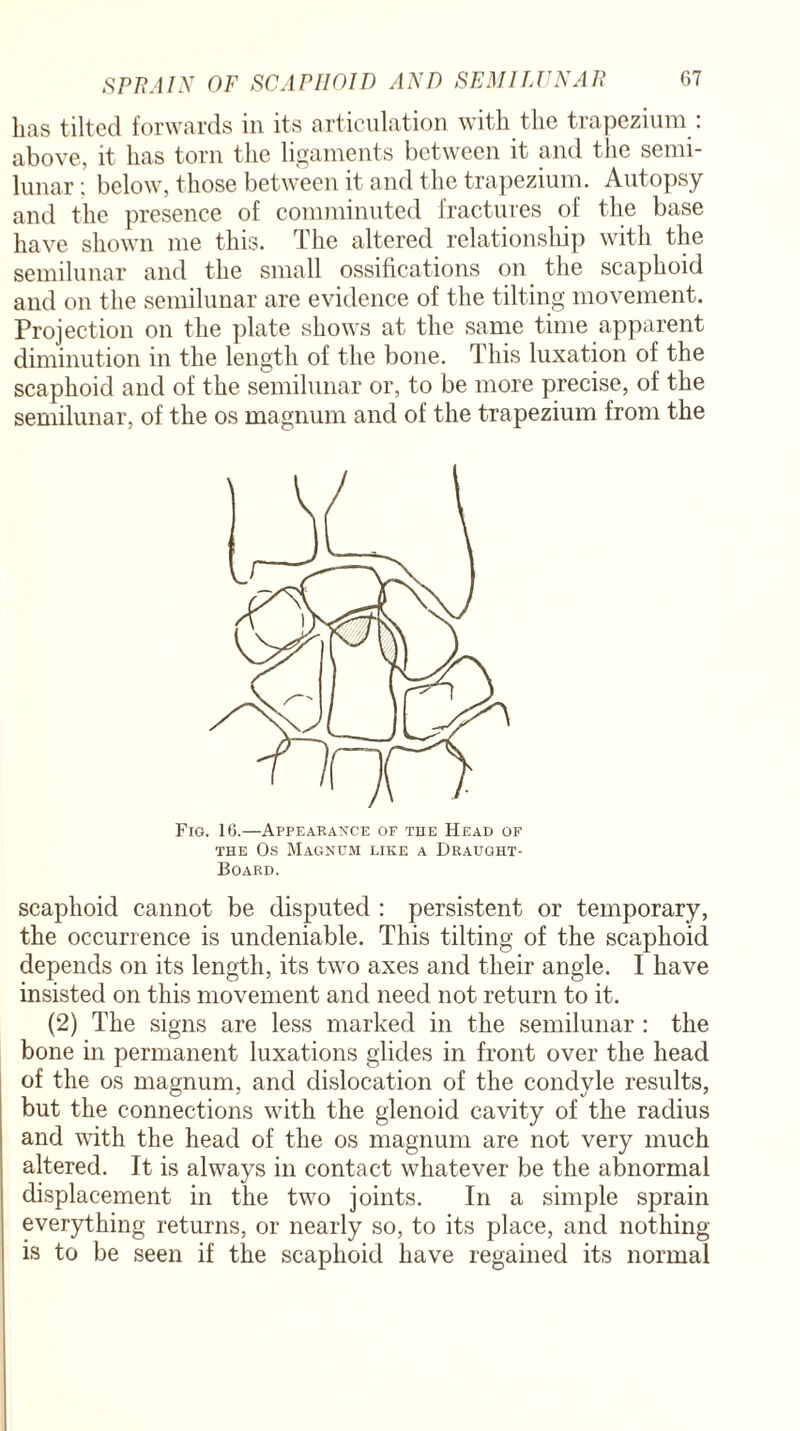 has tilted forwards in its articulation with the trapezium . above, it has torn the ligaments between it and the semi¬ lunar : below, those between it and the trapezium. Autopsy and the presence of comminuted fractures of the base have shown me this. The altered relationship with the semilunar and the small ossifications on the scaphoid and on the semilunar are evidence of the tilting movement. Projection on the plate shows at the same time apparent diminution in the length of the bone. This luxation of the scaphoid and of the semilunar or, to be more precise, of the semilunar, of the os magnum and of the trapezium from the Fig. 16.—Appearance of the Head of the Os Magnum like a Draught- Board. scaphoid cannot be disputed : persistent or temporary, the occurrence is undeniable. This tilting of the scaphoid depends on its length, its two axes and their angle. I have insisted on this movement and need not return to it. (2) The signs are less marked in the semilunar : the bone in permanent luxations glides in front over the head of the os magnum, and dislocation of the condyle results, but the connections with the glenoid cavity of the radius and with the head of the os magnum are not very much altered. It is always in contact whatever be the abnormal displacement in the two joints. In a simple sprain everything returns, or nearly so, to its place, and nothing is to be seen if the scaphoid have regained its normal