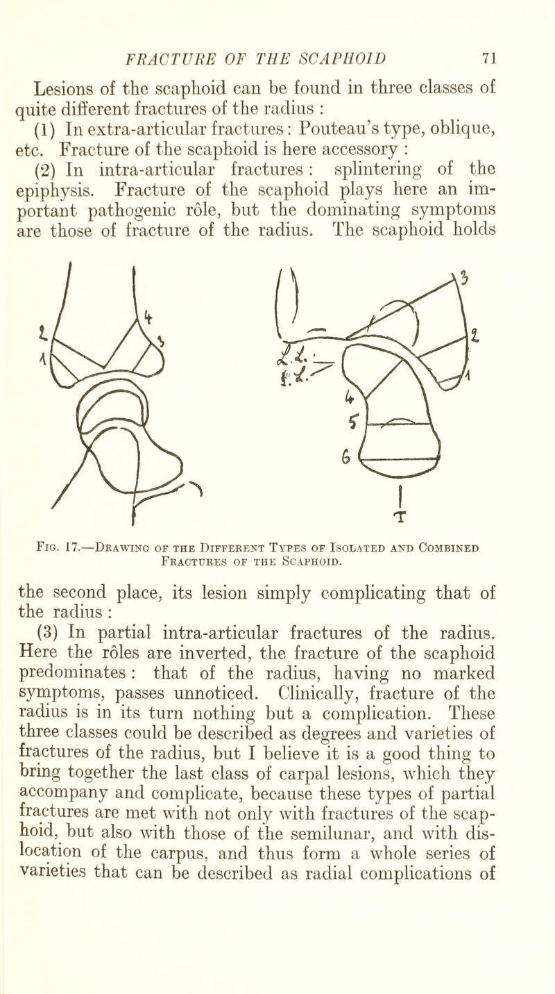 Lesions of the scaphoid can be found in three classes of quite different fractures of the radius : (1) In extra-articular fractures: Pouteau’s type, oblique, etc. Fracture of the scaphoid is here accessory : (2) In intra-articular fractures: splintering of the epiphysis. Fracture of the scaphoid plays here an im¬ portant- pathogenic role, but the dominating symptoms are those of fracture of the radius. The scaphoid holds Fig. 17.—Drawing of the Different Types of Isolated and Combined Fractures of the Scaphoid. the second place, its lesion simply complicating that of the radius: (3) In partial intra-articular fractures of the radius. Here the roles are inverted, the fracture of the scaphoid predominates: that of the radius, having no marked symptoms, passes unnoticed. Clinically, fracture of the radius is in its turn nothing but a complication. These three classes could be described as degrees and varieties of fractures of the radius, but I believe it is a good thing to bring together the last class of carpal lesions, which they accompany and complicate, because these types of partial fractures are met with not only with fractures of the scap¬ hoid, but also with those of the semilunar, and with dis¬ location of the carpus, and thus form a whole series of varieties that can be described as radial complications of