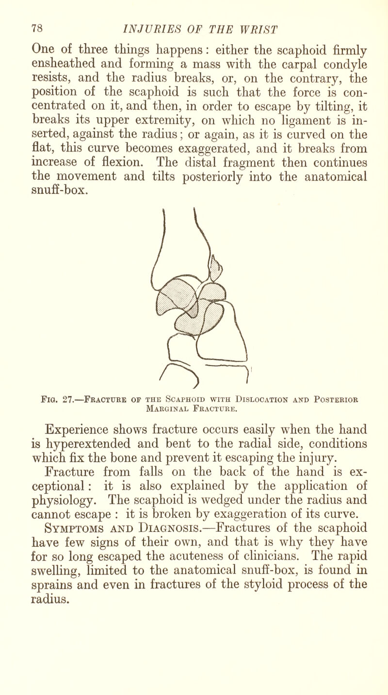 One of three things happens: either the scaphoid firmly ensheathed and forming a mass with the carpal condyle resists, and the radius breaks, or, on the contrary, the position of the scaphoid is such that the force is con¬ centrated on it, and then, in order to escape by tilting, it breaks its upper extremity, on which no ligament is in¬ serted, against the radius; or again, as it is curved on the flat, this curve becomes exaggerated, and it breaks from increase of flexion. The distal fragment then continues the movement and tilts posteriorly into the anatomical snuff-box. Fig. 27.—Fracture op the Scaphoid with Dislocation and Posterior Marginal Fracture. Experience shows fracture occurs easily when the hand is hyperextended and bent to the radial side, conditions which fix the bone and prevent it escaping the injury. Fracture from falls on the back of the hand is ex¬ ceptional : it is also explained by the application of physiology. The scaphoid is wedged under the radius and cannot escape : it is broken by exaggeration of its curve. Symptoms and Diagnosis.—Fractures of the scaphoid have few signs of their own, and that is why they have for so long escaped the acuteness of clinicians. The rapid swelling, limited to the anatomical snuff-box, is found in sprains and even in fractures of the styloid process of the radius.