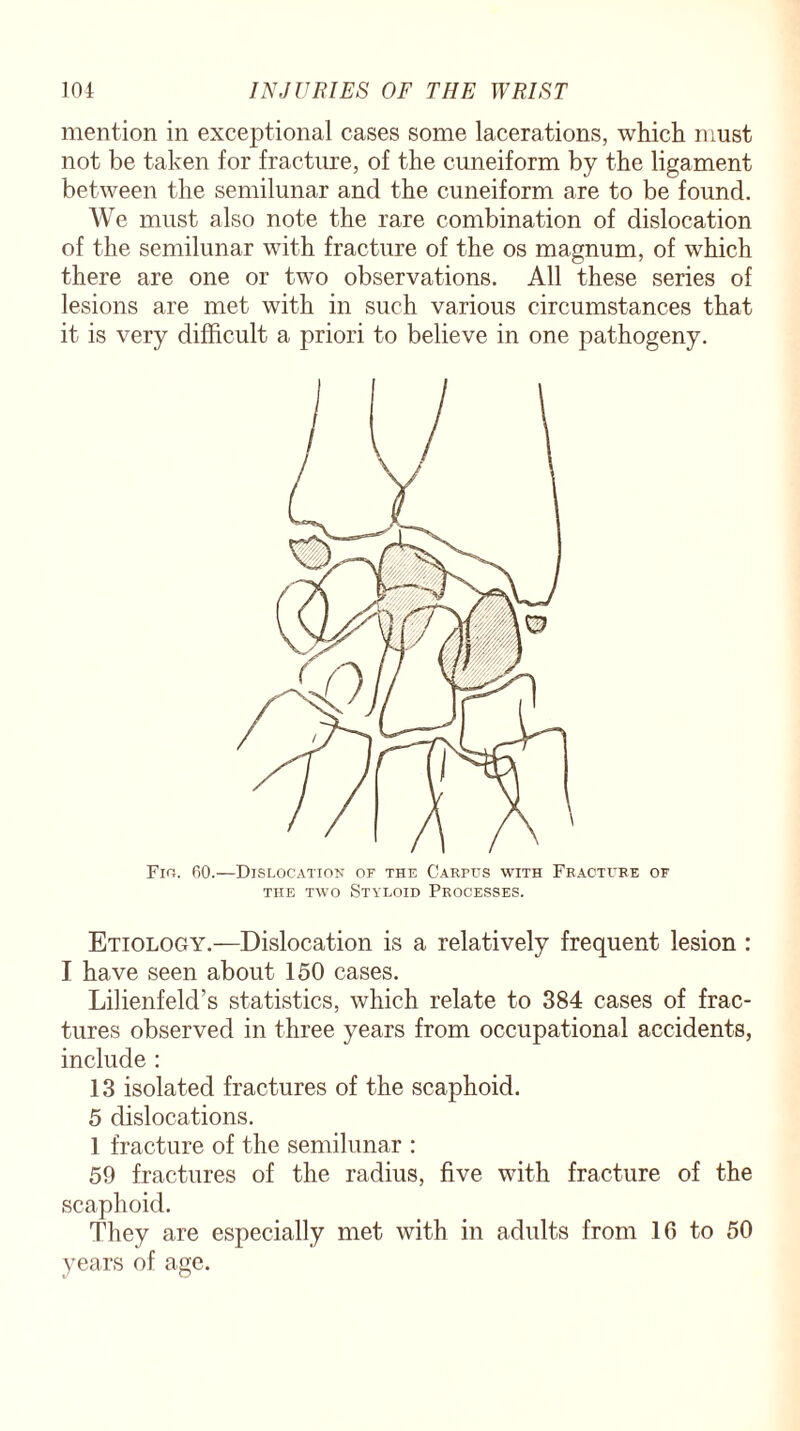 mention in exceptional cases some lacerations, which must not be taken for fracture, of the cuneiform by the ligament between the semilunar and the cuneiform are to be found. We must also note the rare combination of dislocation of the semilunar with fracture of the os magnum, of which there are one or two observations. All these series of lesions are met with in such various circumstances that it is very difficult a priori to believe in one pathogeny. Fin. 60.—Dislocation of the Carpus with Fracture of the two Styloid Processes. Etiology.—Dislocation is a relatively frequent lesion : I have seen about 150 cases. Lilienfeld’s statistics, which relate to 384 cases of frac¬ tures observed in three years from occupational accidents, include : 13 isolated fractures of the scaphoid. 5 dislocations. 1 fracture of the semilunar : 59 fractures of the radius, five with fracture of the scaphoid. They are especially met with in adults from 1G to 50 years of age.