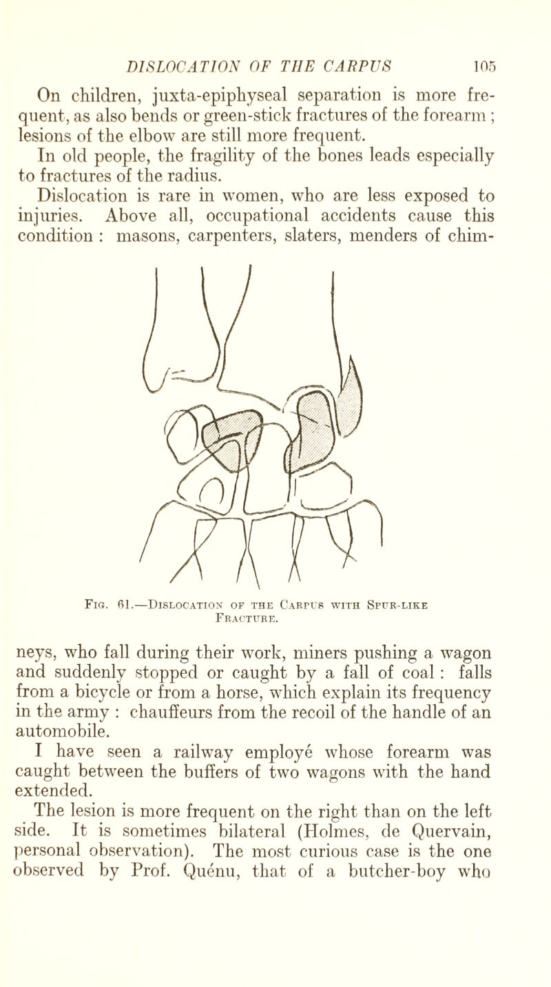 On children, juxta-epiphyseal separation is more fre¬ quent, as also bends or green-stick fractures of the forearm ; lesions of the elbow are still more frequent. In old people, the fragility of the bones leads especially to fractures of the radius. Dislocation is rare in women, who are less exposed to injuries. Above all, occupational accidents cause this condition : masons, carpenters, slaters, menders of chim- Fig. 61.—Dislocation of the Carpus with Spur-like Fracture. neys, who fall during their work, miners pushing a wagon and suddenly stopped or caught by a fall of coal : falls from a bicycle or from a horse, which explain its frequency in the army : chauffeurs from the recoil of the handle of an automobile. I have seen a railway employe whose forearm was caught between the buffers of two wagons with the hand extended. The lesion is more frequent on the right than on the left side. It is sometimes bilateral (Holmes, de Quervain, personal observation). The most curious case is the one observed by Prof. Quenu, that of a butcher-boy who