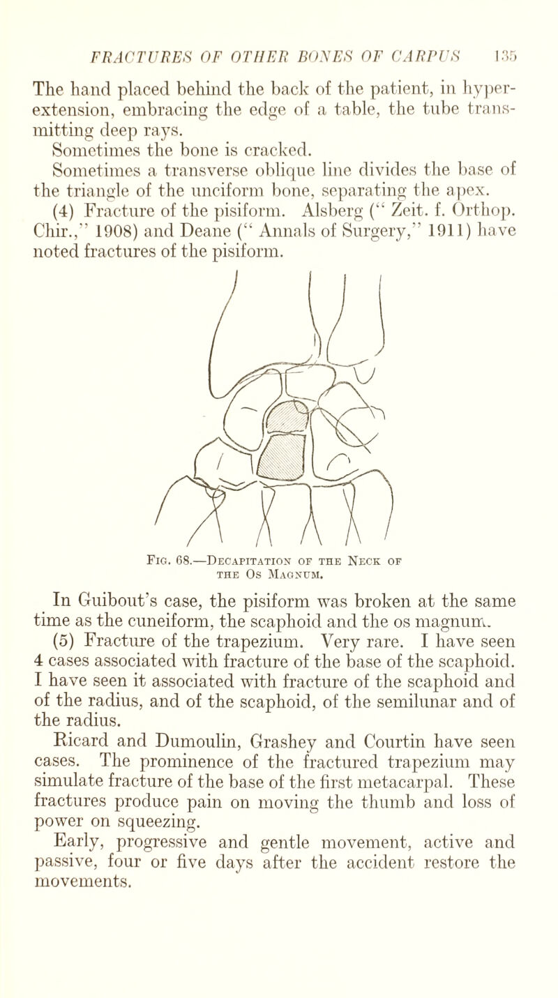 The hand placed behind the back of the patient, in hyper- extension, embracing the edge of a table, the tube trans¬ mitting deep rays. Sometimes the bone is cracked. Sometimes a transverse oblique line divides the base of the triangle of the unciform bone, separating the apex. (4) Fracture of the pisiform. Alsberg (“ Zeit. f. Ortliop. Chir.,” 1908) and Deane (“ Annals of Surgery, 1911) have noted fractures of the pisiform. Fig. 68.—Decapitation of the Neck of the Os Magnum. In Guibout’s case, the pisiform was broken at the same time as the cuneiform, the scaphoid and the os magnum. (5) Fracture of the trapezium. Very rare. I have seen 4 cases associated with fracture of the base of the scaphoid. I have seen it associated with fracture of the scaphoid and of the radius, and of the scaphoid, of the semilunar and of the radius. Ricard and Dumoulin, Grashey and Courtin have seen cases. The prominence of the fractured trapezium may simulate fracture of the base of the first metacarpal. These fractures produce pain on moving the thumb and loss of power on squeezing. Early, progressive and gentle movement, active and passive, four or five days after the accident restore the movements.