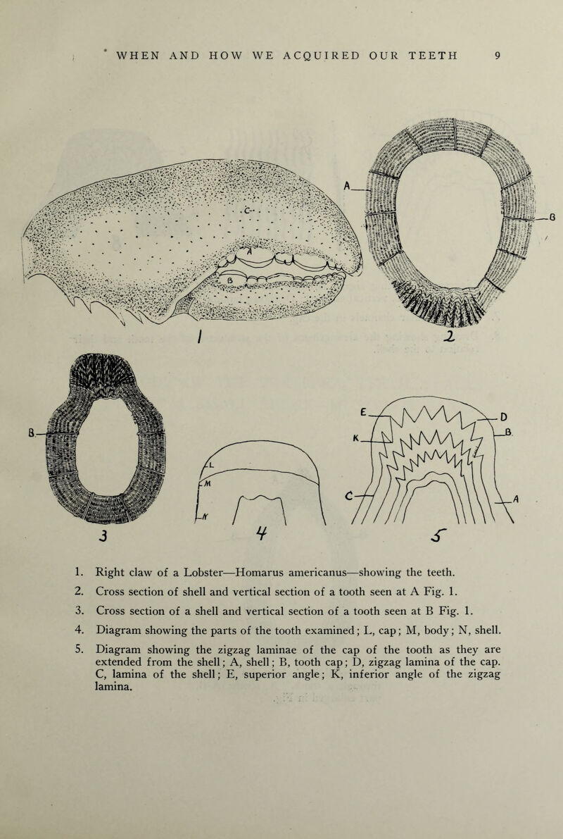 1. Right claw of a Lobster—Homarus americanus—showing the teeth. 2. Cross section of shell and vertical section of a tooth seen at A Fig. 1. 3. Cross section of a shell and vertical section of a tooth seen at B Fig. 1. 4. Diagram showing the parts of the tooth examined; L, cap; M, body; N, shell. 5. Diagram showing the zigzag laminae of the cap of the tooth as they are extended from the shell; A, shell; B, tooth cap; D, zigzag lamina of the cap. C, lamina of the shell; E, superior angle; K, inferior angle of the zigzag lamina.