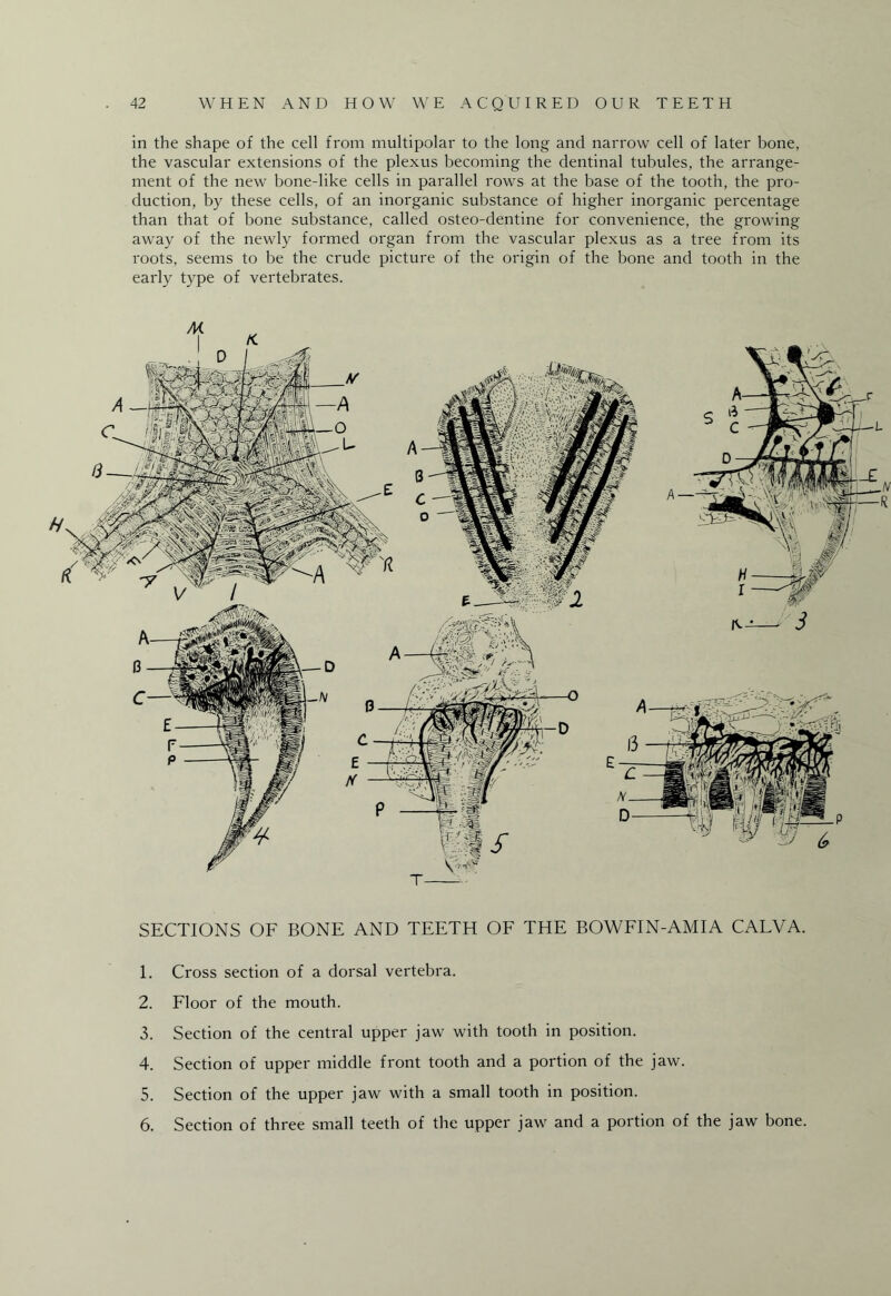 in the shape of the cell from multipolar to the long and narrow cell of later bone, the vascular extensions of the plexus becoming the dentinal tubules, the arrange¬ ment of the new bone-like cells in parallel rows at the base of the tooth, the pro¬ duction, by these cells, of an inorganic substance of higher inorganic percentage than that of bone substance, called osteo-dentine for convenience, the growing away of the newly formed organ from the vascular plexus as a tree from its roots, seems to be the crude picture of the origin of the bone and tooth in the early type of vertebrates. SECTIONS OF BONE AND TEETH OF THE BOWFIN-AMIA CALVA. 1. Cross section of a dorsal vertebra. 2. Floor of the mouth. 3. Section of the central upper jaw with tooth in position. 4. Section of upper middle front tooth and a portion of the jaw. 5. Section of the upper jaw with a small tooth in position. 6. Section of three small teeth of the upper jaw and a portion of the jaw bone.