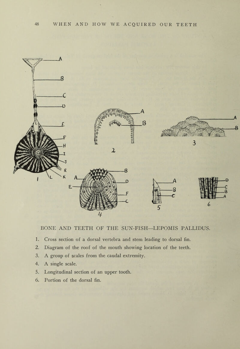 4 BONE AND TEETH OF THE SUN-FISH—LEPOMIS PALLIDUS. 1. Cross section of a dorsal vertebra and stem leading to dorsal fin. 2. Diagram of the roof of the mouth showing location of the teeth. 3. A group of scales from the caudal extremity. 4. A single scale. 5. Longitudinal section of an upper tooth. 6. Portion of the dorsal fin. 03 0