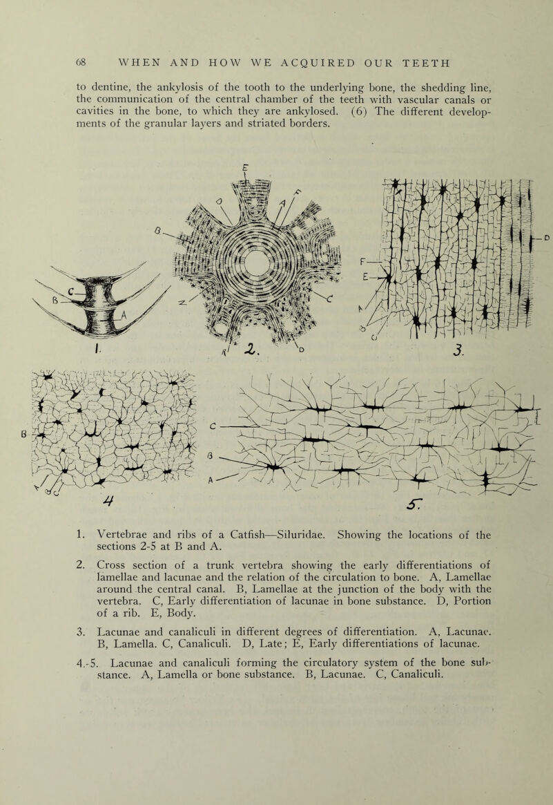 to dentine, the ankylosis of the tooth to the underlying bone, the shedding line, the communication of the central chamber of the teeth with vascular canals or cavities in the bone, to which they are ankylosed. (6) The different develop¬ ments of the granular layers and striated borders. 1. Vertebrae and ribs of a Catfish—Siluridae. Showing the locations of the sections 2-5 at B and A. 2. Cross section of a trunk vertebra showing the early differentiations of lamellae and lacunae and the relation of the circulation to bone. A, Lamellae around the central canal. B, Lamellae at the junction of the body with the vertebra. C, Early differentiation of lacunae in bone substance. D, Portion of a rib. E, Body. 3. Lacunae and canaliculi in different degrees of differentiation. A, Lacunae. B, Lamella. C, Canaliculi. D, Late; E, Early differentiations of lacunae. 4. -5. Lacunae and canaliculi forming the circulatory system of the bone sub¬ stance. A, Lamella or bone substance. B, Lacunae. C, Canaliculi.