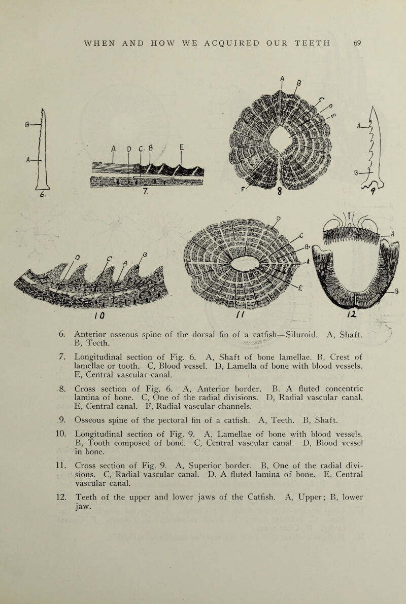 * • -V 6. Anterior osseous spine of the dorsal fin of a catfish—Siluroid. A, Shaft. B, Teeth. 7. Longitudinal section of Fig. 6. A, Shaft of bone lamellae. B, Crest of lamellae or tooth. C, Blood vessel. D, Lamella of bone with blood vessels. E, Central vascular canal. 8. Cross section of Fig. 6. A, Anterior border. B. A fluted concentric lamina of bone. C, One of the radial divisions. D, Radial vascular canal. E, Central canal. F, Radial vascular channels. 9. Osseous spine of the pectoral fin of a catfish. A, Teeth. B, Shaft. 10. Longitudinal section of Fig. 9. A, Lamellae of bone with blood vessels. B, Tooth composed of bone. C, Central vascular canal. D, Blood vessel in bone. 11. Cross section of Fig. 9. A, Superior border. B, One of the radial divi¬ sions. C, Radial vascular canal. D, A fluted lamina of bone. E, Central vascular canal. 12. Teeth of the upper and lower jaws of the Catfish. A, Upper; B, lower jaw.