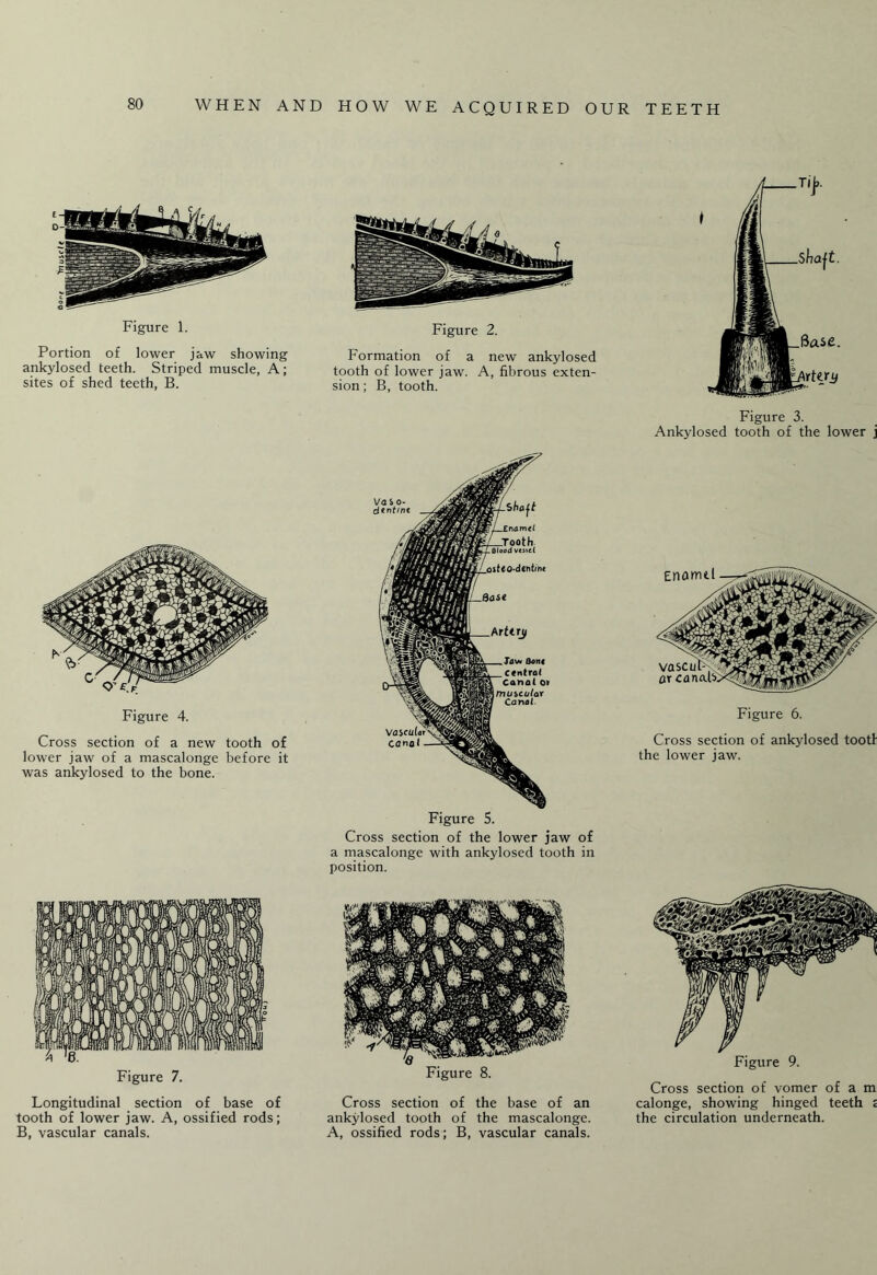 Figure 1. Portion of lower jaw showing ankylosed teeth. Striped muscle, A; sites of shed teeth, B. Figure 4. Cross section of a new tooth of lower jaw of a mascalonge before it was ankylosed to the bone. Figure 7. Longitudinal section of base of tooth of lower jaw. A, ossified rods; B, vascular canals. Figure 2. Formation of a new ankylosed tooth of lower jaw. A, fibrous exten¬ sion; B, tooth. Cross section of the lower jaw of a mascalonge with ankylosed tooth in position. Figure 8. Cross section of the base of an ankylosed tooth of the mascalonge. A, ossified rods; B, vascular canals. Figure 3. Ankylosed tooth of the lower j Figure 6. Cross section of ankylosed tootl the lower jaw. Figure 9. Cross section of vomer of a m calonge, showing hinged teeth t the circulation underneath.