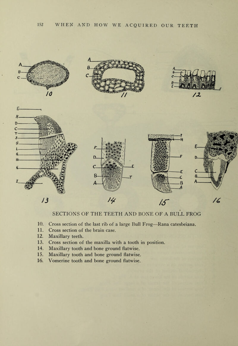 c* -i n SECTIONS OF THE TEETH AND BONE OF A BULL FROG 10. Cross section of the last rib of a large Bull Frog—Rana catesbeiana. 11. Cross section of the brain case. 12. Maxillary teeth. 13. Cross section of the maxilla with a tooth in position. 14. Maxillary tooth and bone ground flatwise. 15. Maxillary tooth and bone ground flatwise. 16. Vomerine tooth and bone ground flatwise.