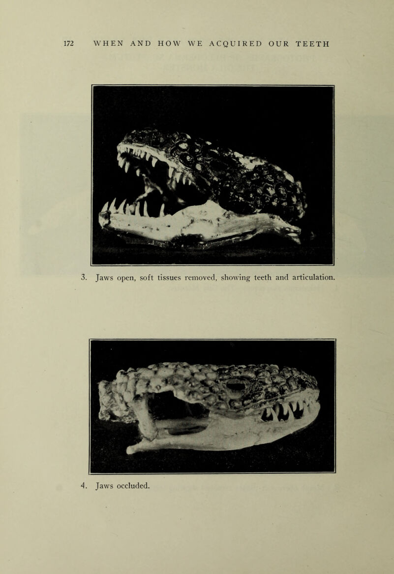 3. Jaws open, soft tissues removed, showing teeth and articulation. 4. Jaws occluded.