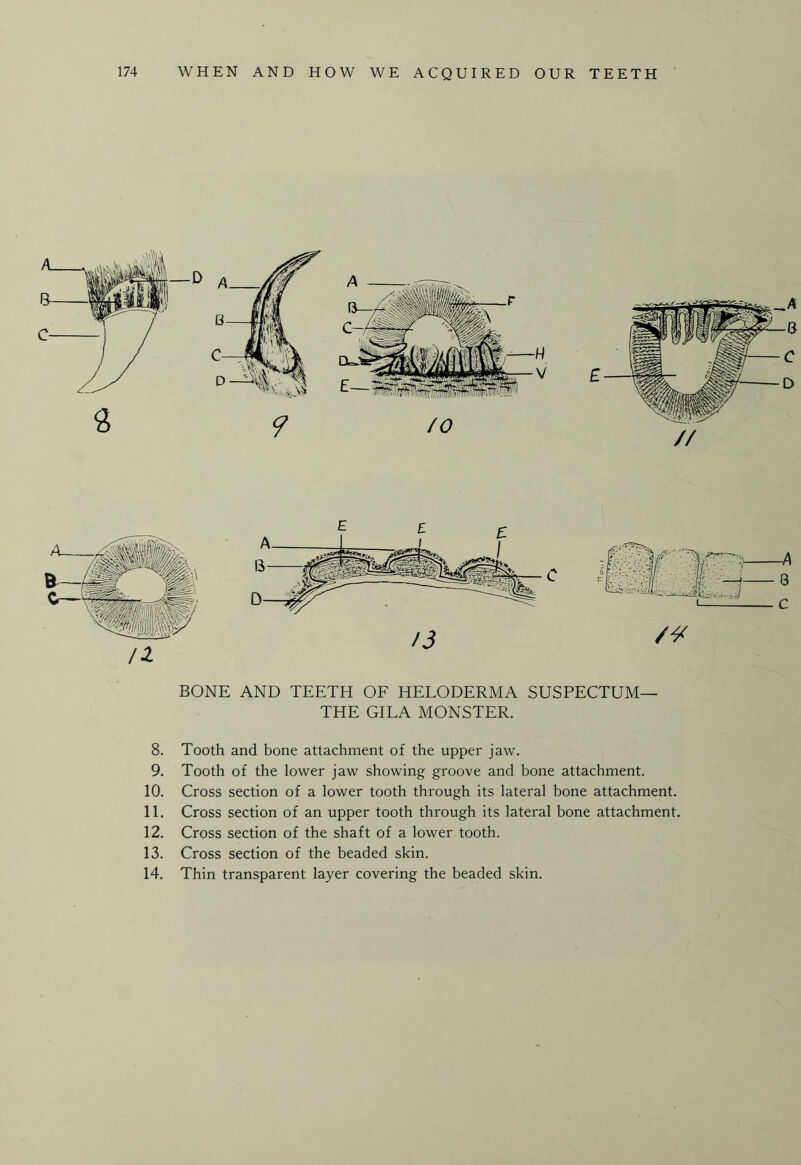 BONE AND TEETH OF HELODERMA SUSPECTUM— THE GILA MONSTER. 8. Tooth and bone attachment of the upper jaw. 9. Tooth of the lower jaw showing groove and bone attachment. 10. Cross section of a lower tooth through its lateral bone attachment. 11. Cross section of an upper tooth through its lateral bone attachment. 12. Cross section of the shaft of a lower tooth. 13. Cross section of the beaded skin. 14. Thin transparent layer covering the beaded skin.
