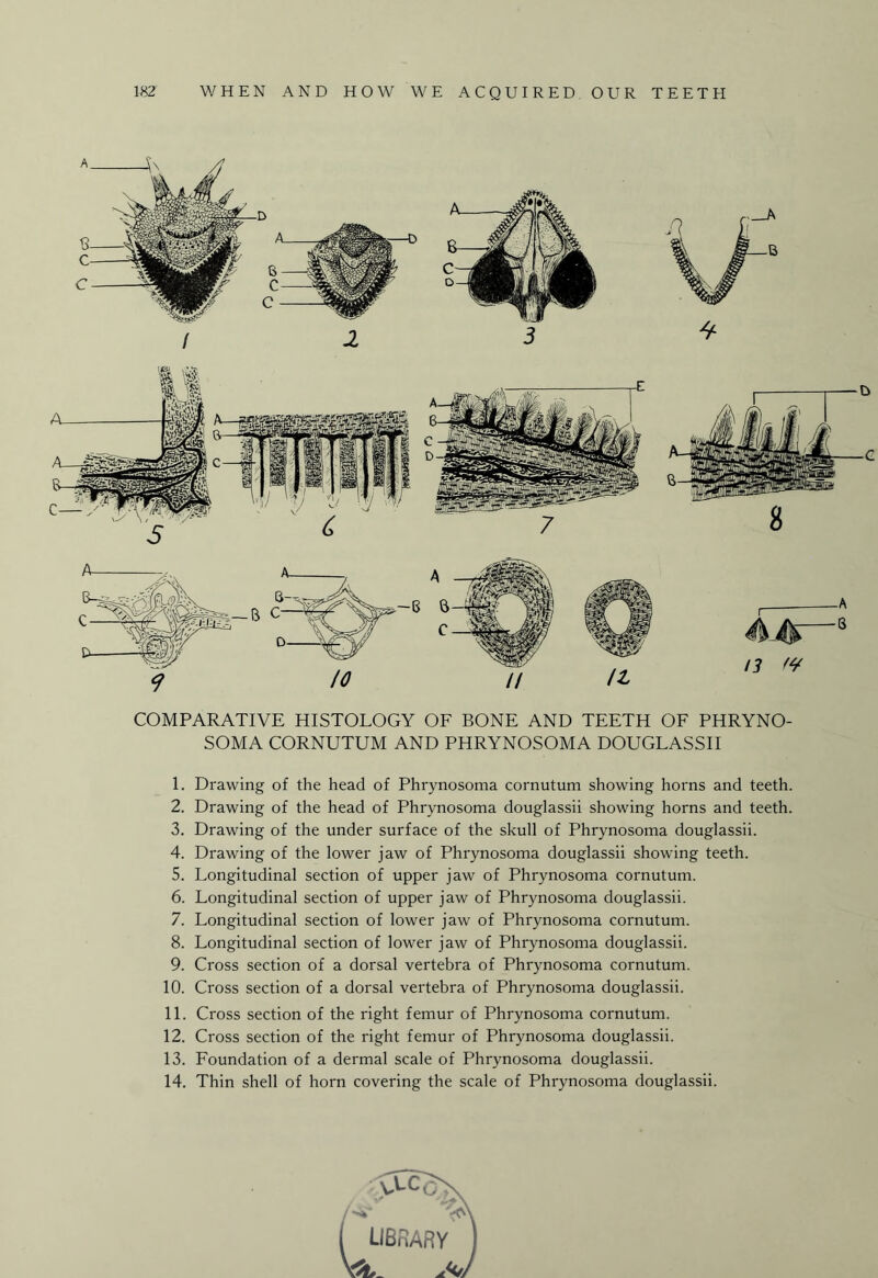 COMPARATIVE HISTOLOGY OF BONE AND TEETH OF PHRYNO- SOMA CORNUTUM AND PHRYNOSOMA DOUGLASSII 1. Drawing of the head of Phrynosoma cornutum showing horns and teeth. 2. Drawing of the head of Phrynosoma douglassii showing horns and teeth. 3. Drawing of the under surface of the skull of Phrynosoma douglassii. 4. Drawing of the lower jaw of Phrynosoma douglassii showing teeth. 5. Longitudinal section of upper jaw of Phrynosoma cornutum. 6. Longitudinal section of upper jaw of Phrynosoma douglassii. 7. Longitudinal section of lower jaw of Phrynosoma cornutum. 8. Longitudinal section of lower jaw of Phrynosoma douglassii. 9. Cross section of a dorsal vertebra of Phrynosoma cornutum. 10. Cross section of a dorsal vertebra of Phrynosoma douglassii. 11. Cross section of the right femur of Phrynosoma cornutum. 12. Cross section of the right femur of Phrynosoma douglassii. 13. Foundation of a dermal scale of Phrynosoma douglassii. 14. Thin shell of horn covering the scale of Phrynosoma douglassii. vtccX /<*r ( LIBRARY ) W jJ