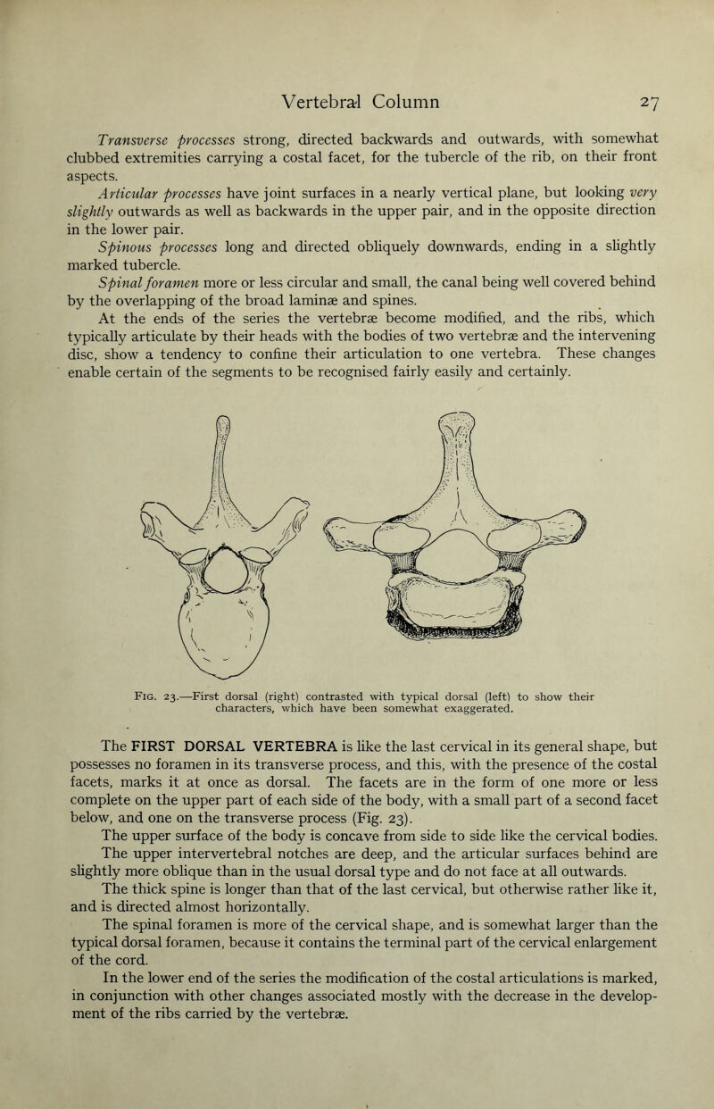 Transverse processes strong, directed backwards and outwards, with somewhat clubbed extremities carrying a costal facet, for the tubercle of the rib, on their front aspects. Articular processes have joint surfaces in a nearly vertical plane, but looking very slightly outwards as well as backwards in the upper pair, and in the opposite direction in the lower pair. Spinous processes long and directed obliquely downwards, ending in a slightly marked tubercle. Spinal foramen more or less circular and small, the canal being well covered behind by the overlapping of the broad laminae and spines. At the ends of the series the vertebrae become modified, and the ribs, which typically articulate by their heads with the bodies of two vertebrae and the intervening disc, show a tendency to confine their articulation to one vertebra. These changes enable certain of the segments to be recognised fairly easily and certainly. Fig. 23.—First dorsal (right) contrasted with typical dorsal (left) to show their characters, which have been somewhat exaggerated. The FIRST DORSAL VERTEBRA is like the last cervical in its general shape, but possesses no foramen in its transverse process, and this, with the presence of the costal facets, marks it at once as dorsal. The facets are in the form of one more or less complete on the upper part of each side of the body, with a small part of a second facet below, and one on the transverse process (Fig. 23). The upper surface of the body is concave from side to side like the cervical bodies. The upper intervertebral notches are deep, and the articular surfaces behind are slightly more oblique than in the usual dorsal type and do not face at all outwards. The thick spine is longer than that of the last cervical, but otherwise rather like it, and is directed almost horizontally. The spinal foramen is more of the cervical shape, and is somewhat larger than the typical dorsal foramen, because it contains the terminal part of the cervical enlargement of the cord. In the lower end of the series the modification of the costal articulations is marked, in conjunction with other changes associated mostly with the decrease in the develop¬ ment of the ribs carried by the vertebrae.