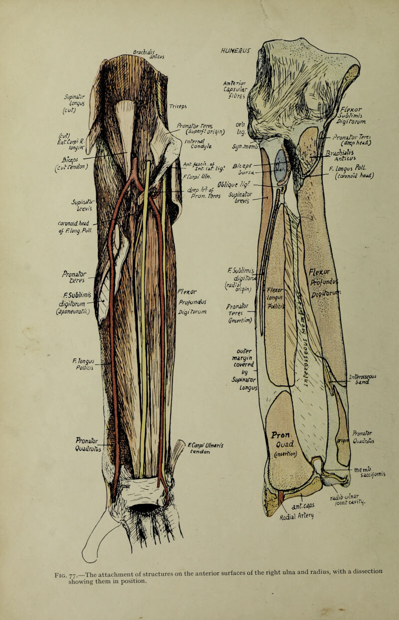 Supinator tongas (cut) (cat) Ext.Carpi R- [ lonfFr bleeps (cut Tendon) Supinator brevis comoid head of Poll. Pronator t<tres FSubJtm digitowm ■ (jponeurolt) F. tongas _ PolUcis Promtor_ QuadVolos Orocfoiis drums HUMERUS Anterior Caps afar fibres triceps Pronator Feres or^ (Sup erf! origin) hg.\ Internal Condjle Sijn.memd [f Carpi R/n. *urS*‘ ,, Oblique UgT ckep h‘l of . Pron. teres Supinator brevis ' I FI ex. or Profundus Dtqitorum FSu bl/m is dlgitoru (ratlin . \ origin) Pronator Tprfi (insertion) outer margin covered by Supinator longus f Flexor fSab/imis ’ d)igi to rum • Pronator Teres (deep head) i rack tabs AnticUi F. longus Poll. (Coronoid head) :x\ Flexor longus Po//iCis | Interosseous band F.Cdrpi Ubaris tendon Pron Quad (insertion) yr/fin Pronator Quadrates mem’J saxo/orims 3.ntCdf£ fedial Artery radio ulnar joint tAwy- p-IG ~j-j__The attachment of structures on the anterior surfaces of the right ulna and radius, with a dissection showing them in position.
