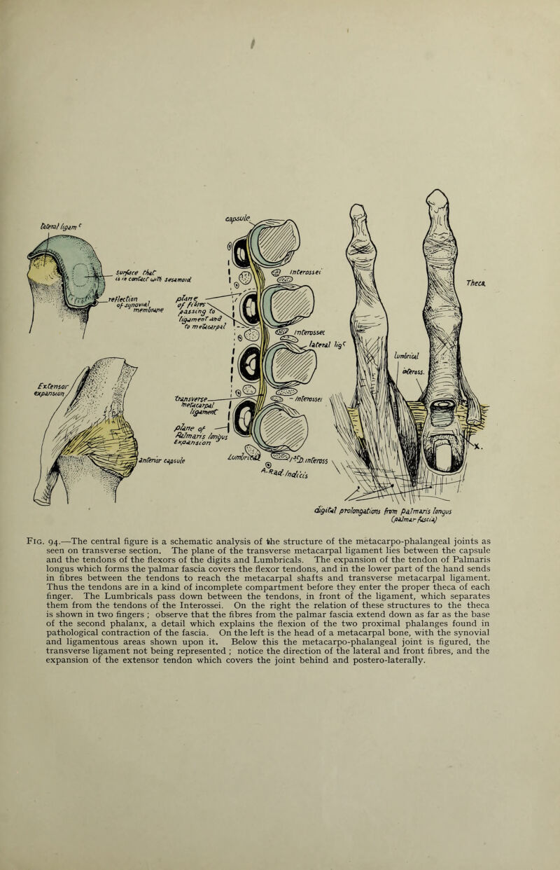 taCerat lyam( Surface that conUcC ojttf} sesamoid reflection plane ofj1/novHI gf film - membrane passing to tigjmenT and digital prolmgatim from palmaris Itmyus (palmar fascia) Fig. 94.—The central figure is a schematic analysis of the structure of the metacarpo-phalangeal joints as seen on transverse section. The plane of the transverse metacarpal ligament lies between the capsule and the tendons of the flexors of the digits and Lumbricals. The expansion of the tendon of Palmaris longus which forms the palmar fascia covers the flexor tendons, and in the lower part of the hand sends in fibres between the tendons to reach the metacarpal shafts and transverse metacarpal ligament. Thus the tendons are in a kind of incomplete compartment before they enter the proper theca of each finger. The Lumbricals pass down between the tendons, in front of the ligament, which separates them from the tendons of the Interossei. On the right the relation of these structures to the theca is shown in two fingers ; observe that the fibres from the palmar fascia extend down as far as the base of the second phalanx, a detail which explains the flexion of the two proximal phalanges found in pathological contraction of the fascia. On the left is the head of a metacarpal bone, with the synovial and ligamentous areas shown upon it. Below this the metacarpo-phalangeal joint is figured, the transverse ligament not being represented ; notice the direction of the lateral and front fibres, and the expansion of the extensor tendon which covers the joint behind and postero-laterally.