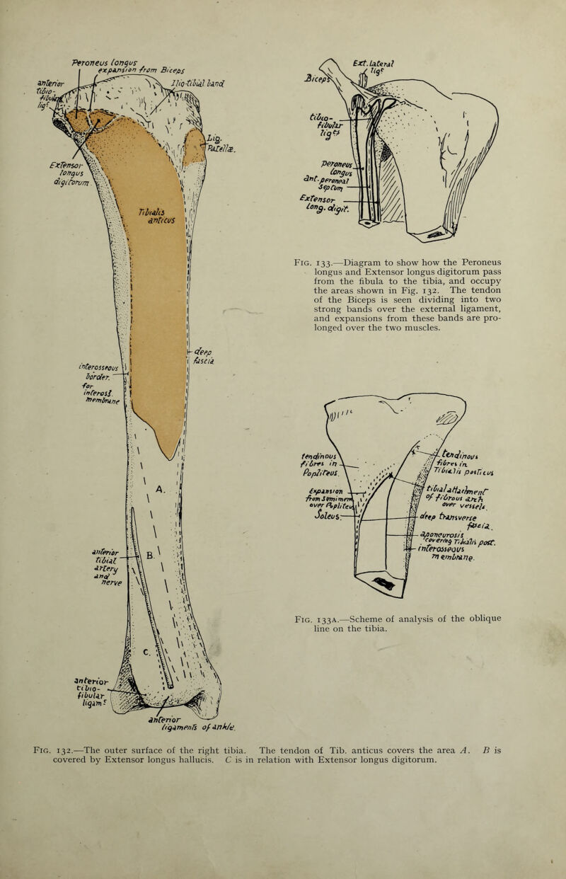 Fig. 133.—Diagram to show how the Peroneus longus and Extensor longus digitorum pass from the fibula to the tibia, and occupy the areas shown in Fig. 132. The tendon of the Biceps is seen dividing into two strong bands over the external ligament, and expansions from these bands are pro¬ longed over the two muscles. tinc/inous film in Pop!it~eol itpinvo'n from Stnrvm over Popliteu Soleus tin Jin ou 1 / film in, '.ty Ti6titJ/i petT/tus v/ °f fior-out d.nh :y/ ovfir vessels, drtp tip/jivcne fVcij, aponeurosis eeverng T.lrdhi poft. tnterosseous ^liinlrranp. Fig. 133A.—Scheme of analysis of the oblique line on the tibia. Fig. 132.—The outer surface of the right tibia. The tendon of Tib. anticus covers the area A. covered by Extensor longus hallucis. C is in relation with Extensor longus digitorum. B is