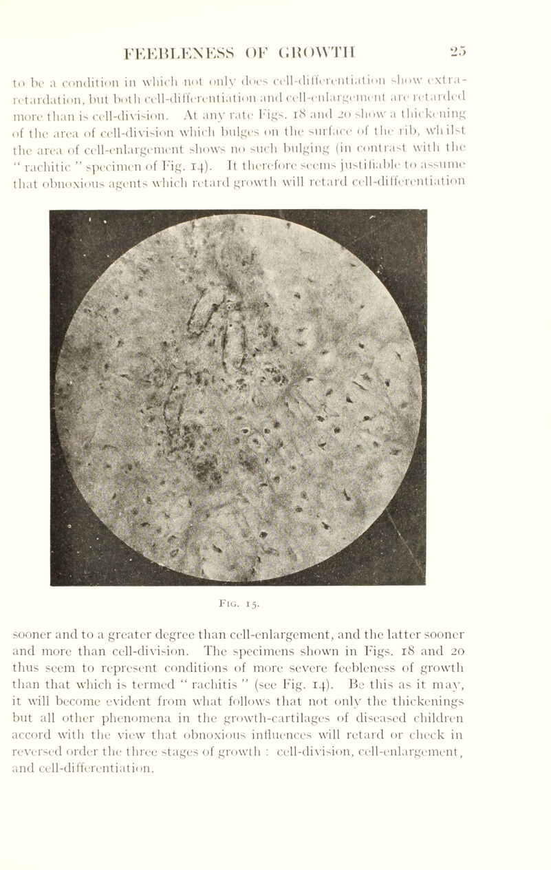 to be a condition in which not only docs ccll-dilferentiation show extra- retardation, but both cell-differentiation and cell-enlargement are retarded more than is cell-division. At any rate l'igs. 18 and 20 show a thickening of the area of cell-division which bulges on the surface of the rib, whilst the area of cell-enlargement shows no such bulging (in contrast with the “ rachitic ” specimen of b'ig. 14). It therefore seems justifiable to assume that obnoxious agents which retard growth will retard cell-dilferentiation Fig. 15. sooner and to a greater degree than cell-enlargement, and the latter sooner and more than cell-division. The specimens shown in Figs. 18 and 20 thus seem to represent conditions of more severe feebleness of growth than that which is termed “ rachitis ” (see Fig. 14). Be this as it may, it will become evident from what follows that not only the thickenings but all other phenomena in the growth-cartilages of diseased children accord with the view that obnoxious influences will retard or check in reversed order the three stages of growth : cell-division, cell-enlargement, and cell-differentiation.