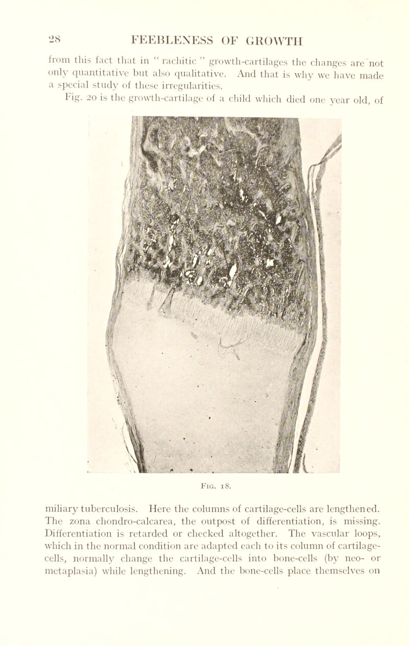 irom this fact that in “ rachitic ” growth-cartilages the changes are not only quantitative but also qualitative. And that is why we have made a special study of these irregularities. Fig. 20 is the growth-cartilage of a child which died one year old, of Fig. i 8. miliary tuberculosis. Here the columns of cartilage-cells are lengthened. The zona chondro-calcarea, the outpost of differentiation, is missing. Differentiation is retarded or checked altogether. The vascular loops, which in the normal condition are adapted each to its column of cartilage- cells, normally change the cartilage-cells into bone-cells (by neo- or metaplasia) while lengthening. And the bone-cells place themselves on