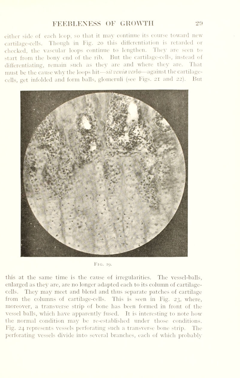 cither side of each loop, so that it may continue its course toward new cartilage-cells. Though in Fig. 20 this differentiation is retarded or checked, the vascular loops continue to lengthen. I hey arc seen to start from the bony end of the rib. But the cartilage-cells, instead of differentiating, remain such as they are and where they are. J hat must be the cause why the loops hit—sitvenia verbo—against the cartilage- cells, get infolded and form balls, glomeruli (see Figs. 21 and 22). But Fig. 19. this at the same time is the cause of irregularities. The vessel-balls, enlarged as they are, are no longer adapted each to its column of cartilage- cells. They may meet and blend and thus separate patches of cartilage from the columns of cartilage-cells. This is seen in Fig. 23, where, moreover, a transverse strip of bone has been formed in front of the vessel balls, which have apparently fused. It is interesting to note how the normal condition may be re-established under those conditions. Fig. 24 represents vessels perforating such a transverse bone strip. The perforating vessels divide into several branches, each of which probablv