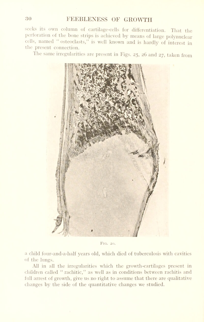 seeks its own column of cartilage-cells for differentiation. That the perforation of the bone strips is achieved by means of large polynuclear cells, named “ osteoclasts,” is well known and is hardly of interest in the present connection. lhe same irregularities arc present in Figs. 25, 26 and 27, taken from Fig. 20. a child four-and-a-half years old, which died of tuberculosis with cavities of the lungs. All in all the irregularities which the growth-cartilages present in children called “ rachitic,” as well as in conditions between rachitis and full arrest of growth, give us no right to assume that there are qualitative changes by the side of the quantitative changes we studied.