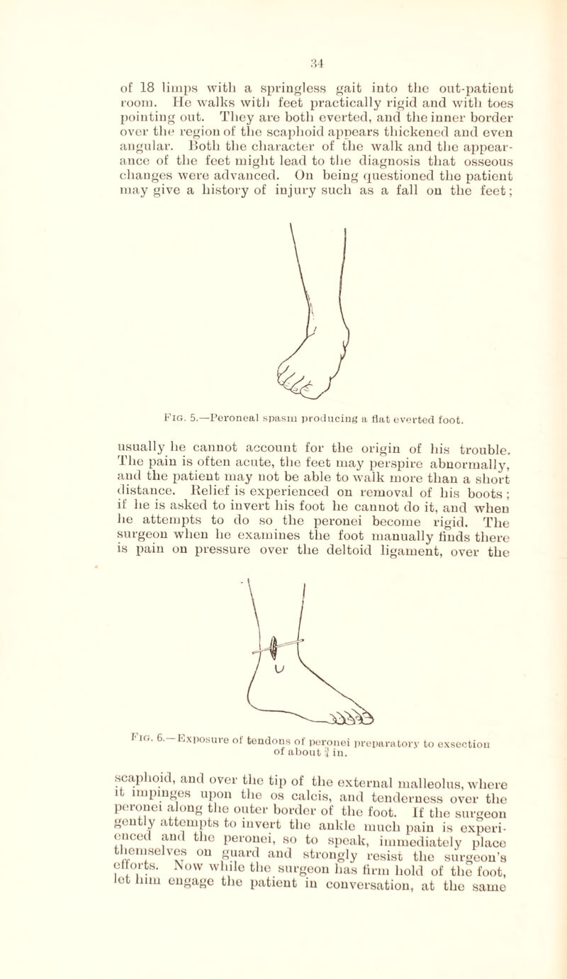 of 18 limps with a springless gait into the out-patient room. He walks with feet practically rigid and with toes pointing out. They are both everted, and the inner border over the region of the scaphoid appears thickened and even angular. Both the character of the walk and the appear¬ ance of the feet might lead to the diagnosis that osseous changes were advanced. On being questioned the patient may give a history of injury such as a fall on the feet; Fig. 5.—Peroneal spasm producing a flat everted foot. usually he cannot account for the origin of his trouble. The pain is often acute, the feet may perspire abnormally, and the patient may not be able to walk more than a short distance. Relief is experienced on removal of his boots; if he is asked to invert his foot he canuot do it, and when he attempts to do so the peronei become rigid. The surgeon when he examines the foot manually finds there is pain on pressure over the deltoid ligament, over the I in. 6. Exposure of tendons of peronei preparatory to exsectiou of about if in. scaphoid, and over the tip of the external malleolus, where it impinges upon the os calcis, and tenderness over the peronei along the outer border of the foot. If the surgeon gently attempts to invert the ankle much pain is experi¬ enced and the peronei, so to speak, immediately place themselves on guard and strongly resist the surgeon’s eflorts. Now while the surgeon has firm hold of the foot, let fmn engage the patient in conversation, at the same