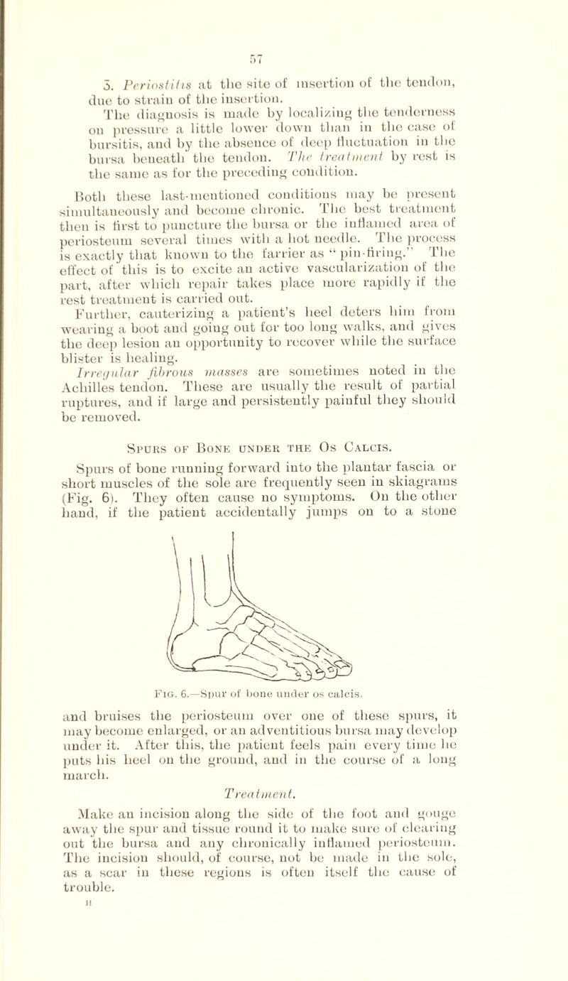 r»7 5. Periostitis at the site of insertion of the tendon, due to strain of the insertion. The diagnosis is made by localizing the tenderness on pressure a little lower down than in the case of bursitis, and by the absence of deep fluctuation in the bursa beneath tho tendon. The treatment by rest is the same as for the preceding condition. Both these last-mentioned conditions may be present simultaneously and become chronic. The best treatment then is first to puncture the bursa or tho inflamed area of periosteum several times with a hot needle. The process is exactly that known to the farrier as “ pin-firing.” The effect of this is to excite an active vascularization of the part, after which repair takes place more rapidly if the rest treatment is carried out. Further, cauterizing a patient’s heel deters him from wearing a boot and going out for too long walks, and gives the deep lesion an opportunity to recover while the surface blister is healing. Irregular fibrous masses are sometimes noted in the Achilles tendon. These are usually the result of partial ruptures, and if large and persistently painful they should be removed. Spurs of Bone under the Os Calcis. Spurs of bone running forward into the plantar fascia or short muscles of the sole are frequently seen in skiagrams (Fig. 6). They often cause no symptoms. On the other hand, if the patient accidentally jumps on to a stone and bruises the periosteum over one of these spurs, it may become enlarged, or an adventitious bursa may develop under it. After this, the patient feels pain every time he puts his heel on the ground, and in the course of a long march. Treatment. Make au incision along the side of the foot aud gouge away the spur and tissue round it to make sure of clearing out the bursa and any chronically inflamed periosteum. The incision should, of course, not be made in the sole, as a scar in these regions is often itself the cause of trouble, u