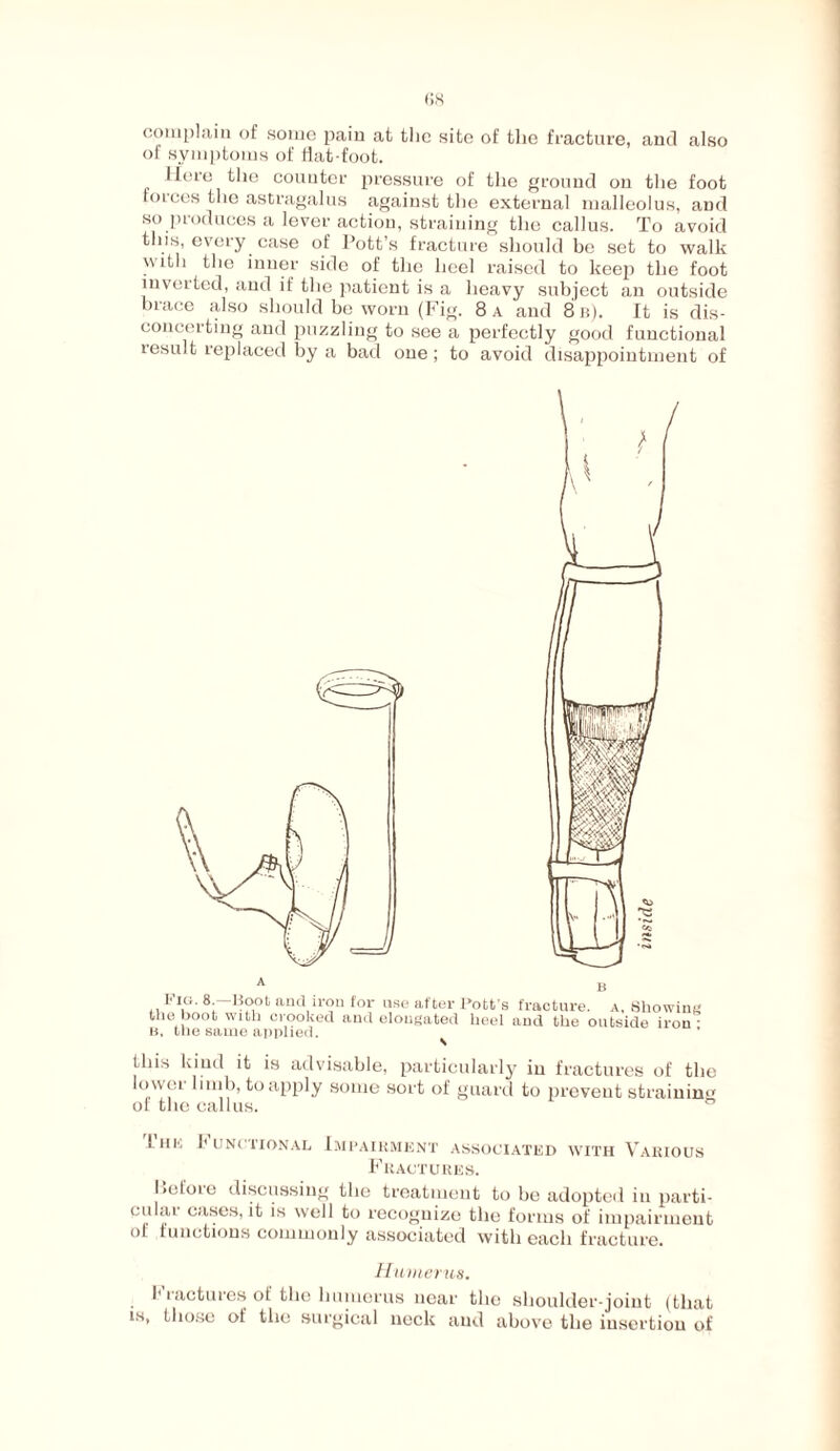 complain of some pain at tlic site of tlic fracture, and also of symptoms of flat-foot. Here the counter pressure of the ground on the foot forces the astragalus against the external malleolus, and so produces a lever action, straining the callus. To avoid this, every case of Pott’s fracture should be set to walk with the inner side of the heel raised to keep the foot inverted, and if the patient is a heavy subject an outside brace also should bo worn (Fig. 8 a and 8 b). It is dis¬ concerting and puzzling to see a perfectly good functional result replaced by a bad one; to avoid disappointment of this kind it is advisable, particularly in fractures of the lower limb, to apply some sort of guard to prevent strainin*r of the callus. lino I« uni tional Impairment associated with Various Fractures. before discussing the treatment to be adopted in parti, cular cases, it is well to recognize the forms of impairment of functions commonly associated with each fracture. Humerus. I1 ractures of the humerus near the shoulder-joint (that is, those of the surgical neck and above the insertion of