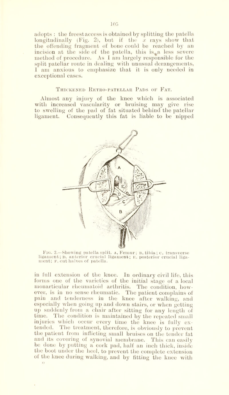 adopts : the freestaccess is obtained by splitting the patella longitudinally (Fig. 2), but if the x rays show that the offending fragment of bone could be reached by an incision at the side of the patella, this is^a less severe method of procedure. As I am largely responsible for the split patellar route in dealing with unusual derangements, 1 am anxious to emphasize that it is only needed in exceptional cases. Thickened Retro-patellar Pads of Fat. Almost any injury of the knee which is associated with increased vascularity or bruising may give rise to swelling of the pad of fat situated behind the patellar ligament. Consequently this fat is liable to be nipped Fig. 2.—Showing patella split, a, Femur; b, tibia; c, transverse ligament; d, anterior crucial ligament; k, posterior crucial liga¬ ment; f, cut halves of patella. in full extension of the knee. In ordinary civil life, this forms one of the varieties of the initial stage of a local monarticular rheumatoid arthritis. The condition, how¬ ever, is in no sense rheumatic. The patient complains of pain and tenderness in the knee after walking, and especially when going up and down stairs, or when getting up suddenly from a chair after sitting for any length of time. The condition is maintained by the repeated small injuries which occur every time the knee is fully ex¬ tended. I'lie treatment, therefore, is obviously to prevent the patient from indicting small bruises on the tender fat and its covering of synovial membrane. This can easily be done by putting a cork pad, half an inch thick, inside the boot under the heel, to prevent the complete extension of the knee during walking, and by fitting the knee with