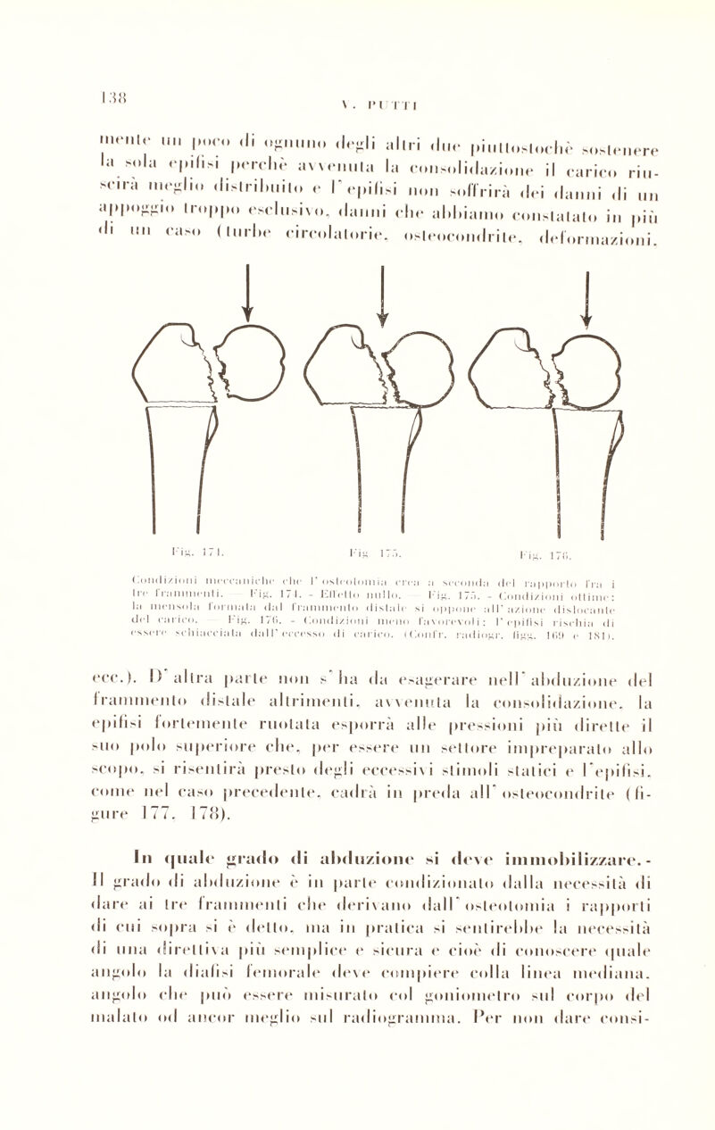 \M\ ,nel<  lMM‘° (li degli all ri due piullosloeliè sostenere la -ola epifisi pordiò avvenuta la co..solillazione il carico riu- sc.ra meglio distribuito c I' epifisi non soffrirà .lei danni .li „„ appoggio troppo esclusivo, danni clic al.lda.no constatalo in più <fl u raso (u,rl,e circolatone, oslcocon.lrilc, deformazioni. (.ondizinni ìiicci'aiiic'lie clic 1’ ostentimi in orca a seconda del rapporto I ra i ^1 ( 11 annuenti. t’i^. 1/ I. - Ir. 11 cito nullo. I*ig, l/a. - (londi/ioni ottimo: la mensola formata dal frammento distale si oppone all’azione dislocante did carico. l'ig. 170. - Condizioni meno favorevoli: l'epifisi rischia ili essere schiacciata dall’eccesso di carico. (Confi', radiosi', figo,. Kii) e 1811. ecc.). I) altra parie non s Ita da esagerare nell abduzione del 1 rammento disiale allrimenli. avvenuta la consolidazione, la epifisi fortemente ruotata esporrà alle pressioni più dirette il suo polo superiore che, per essere un settore impreparato allo scopo, si risentirà presto degli eccessivi stimoli slittici e Iepifisi, come nel caso precedente, cadrà in preda all osleocondrile (li¬ gure 177. 178). In .piale grado di abduzione si deve immobilizzare. - Il grado di alxluzione è in parte condizionalo dalla necessità di dare ai tre frammenti die derivano dall osteotomia i rapporti di cui sopra si è dello, ma in pratica si sentirebbe la necessità di una direttiva pii. semplice e sicura e cioè di conoscere .piale angolo Iti dialisi lemorale deve compiere colla linea mediana, angolo die può essere misuralo col goniometro sul corpo del malato od ancor meglio sul radiogramma. Per non dare consi-