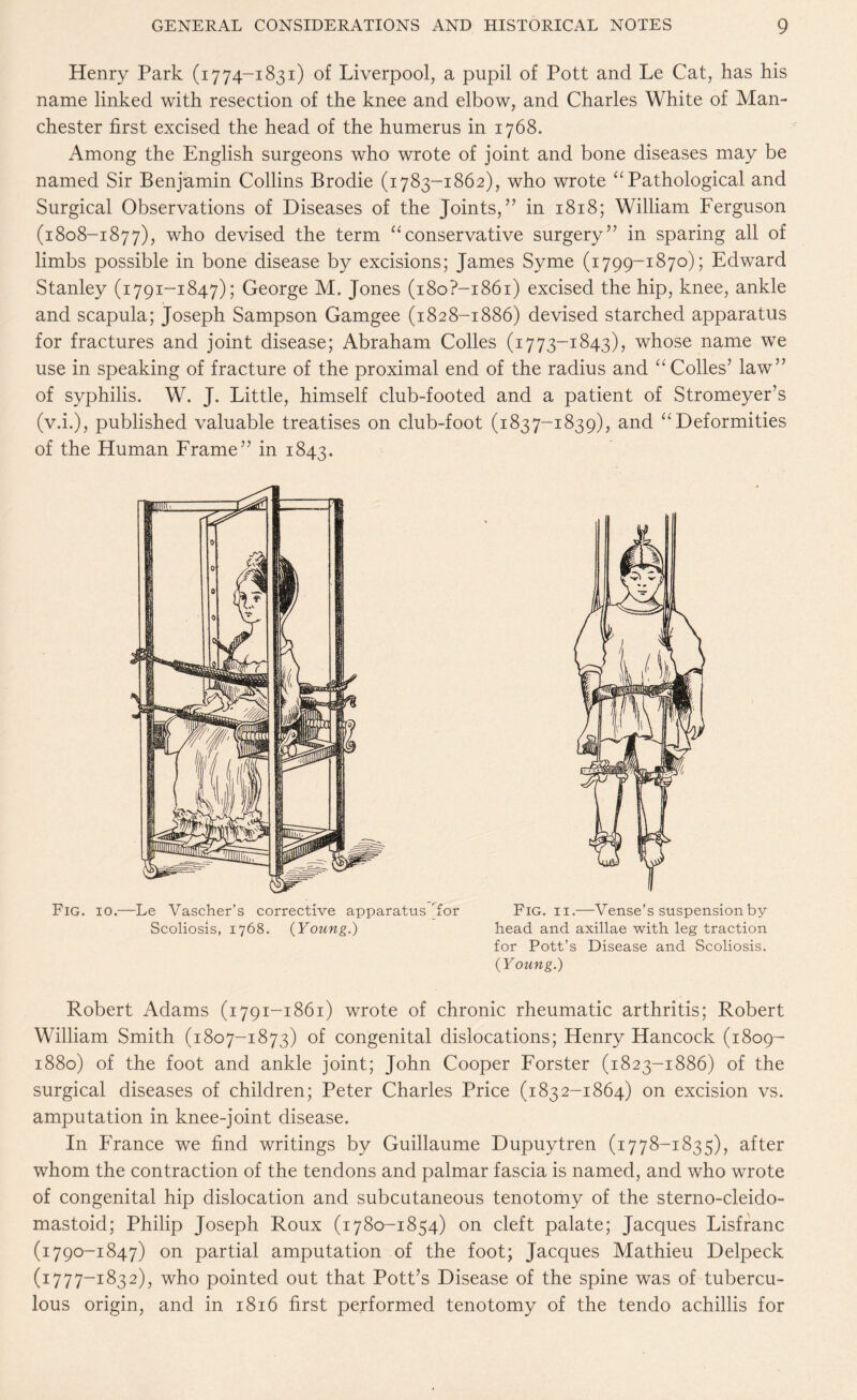 Henry Park (1774-1831) of Liverpool, a pupil of Pott and Le Cat, has his name linked with resection of the knee and elbow, and Charles White of Man¬ chester first excised the head of the humerus in 1768. Among the English surgeons who wrote of joint and bone diseases may be named Sir Benjamin Collins Brodie (1783-1862), who wrote “ Pathological and Surgical Observations of Diseases of the Joints,” in 1818; William Ferguson (1808-1877), who devised the term “conservative surgery” in sparing all of limbs possible in bone disease by excisions; James Syme (1799-1870); Edward Stanley (1791-1847); George M, Jones (i8o?-i86i) excised the hip, knee, ankle and scapula; Joseph Sampson Gamgee (1828-1886) devised starched apparatus for fractures and joint disease; Abraham Colles (1773-1843), whose name we use in speaking of fracture of the proximal end of the radius and “Colles’ law” of syphilis. W. J. Little, himself club-footed and a patient of Stromeyer’s (v.i.), published valuable treatises on club-foot (1837-1839), and “Deformities of the Human Frame” in 1843. Fig. 10.—Le Vascher’s corrective apparatus Tor Scoliosis, 1768. (Young.) Fig. 11.—Vense’s suspension by bead and axillae with leg traction for Pott’s Disease and Scoliosis. (Young.) Robert Adams (1791-1861) wrote of chronic rheumatic arthritis; Robert William Smith (1807-1873) of congenital dislocations; Henry Hancock (1809- 1880) of the foot and ankle joint; John Cooper Forster (1823-1886) of the surgical diseases of children; Peter Charles Price (1832-1864) on excision vs. amputation in knee-joint disease. In France we find writings by Guillaume Dupuytren (1778-1835), after whom the contraction of the tendons and palmar fascia is named, and who wrote of congenital hip dislocation and subcutaneous tenotomy of the sterno-cleido- mastoid; Philip Joseph Roux (1780-1854) on cleft palate; Jacques Lisfranc (1790-1847) on partial amputation of the foot; Jacques Mathieu Delpeck (1777-1832), who pointed out that Pott’s Disease of the spine was of tubercu¬ lous origin, and in 1816 first performed tenotomy of the tendo achillis for