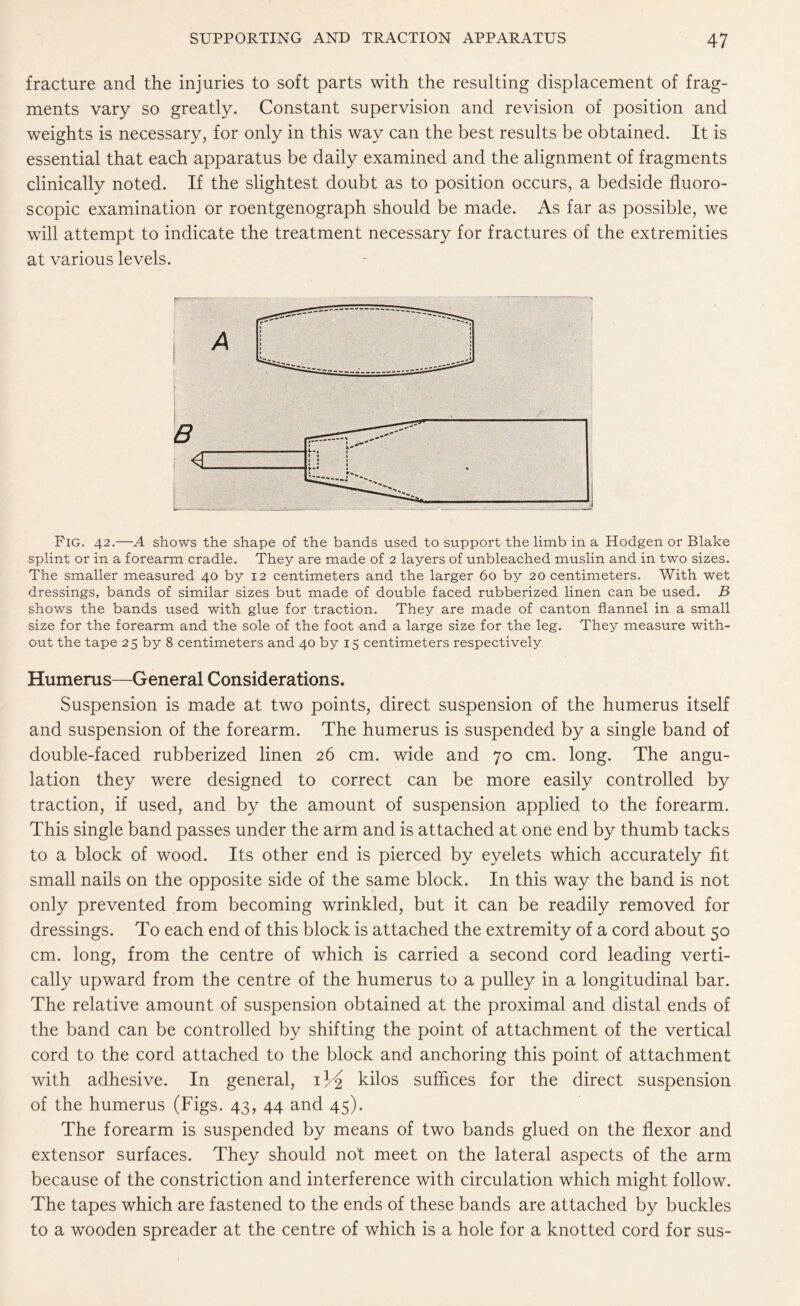 fracture and the injuries to soft parts with the resulting displacement of frag¬ ments vary so greatly. Constant supervision and revision of position and weights is necessary, for only in this way can the best results be obtained. It is essential that each apparatus be daily examined and the alignment of fragments clinically noted. If the slightest doubt as to position occurs, a bedside fluoro¬ scopic examination or roentgenograph should be made. As far as possible, we will attempt to indicate the treatment necessary for fractures of the extremities at various levels. Fig. 42.—A shows the shape of the bands used to support the limb in a Hodgen or Blake splint or in a forearm cradle. They are made of 2 layers of unbleached muslin and in two sizes. The smaller measured 40 by 12 centimeters and the larger 60 by 20 centimeters. With wet dressings, bands of similar sizes but made of double faced rubberized linen can be used. B shows the bands used with glue for traction. They are made of canton flannel in a small size for the forearm and the sole of the foot -and a large size for the leg. They measure with¬ out the tape 25 by 8 centimeters and 40 by 15 centimeters respectively Humerus—General Considerations. Suspension is made at two points, direct suspension of the humerus itself and suspension of the forearm. The humerus is suspended by a single band of double-faced rubberized linen 26 cm. wide and 70 cm. long. The angu¬ lation they were designed to correct can be more easily controlled by traction, if used, and by the amount of suspension applied to the forearm. This single band passes under the arm and is attached at one end by thumb tacks to a block of wood. Its other end is pierced by eyelets which accurately fit small nails on the opposite side of the same block. In this way the band is not only prevented from becoming wrinkled, but it can be readily removed for dressings. To each end of this block is attached the extremity of a cord about 50 cm. long, from the centre of which is carried a second cord leading verti¬ cally upward from the centre of the humerus to a pulley in a longitudinal bar. The relative amount of suspension obtained at the proximal and distal ends of the band can be controlled by shifting the point of attachment of the vertical cord to the cord attached to the block and anchoring this point of attachment with adhesive. In general, 1^2 kilos suffices for the direct suspension of the humerus (Figs. 43, 44 and 45). The forearm is suspended by means of two bands glued on the flexor and extensor surfaces. They should not meet on the lateral aspects of the arm because of the constriction and interference with circulation which might follow. The tapes which are fastened to the ends of these bands are attached by buckles to a wooden spreader at the centre of which is a hole for a knotted cord for sus-