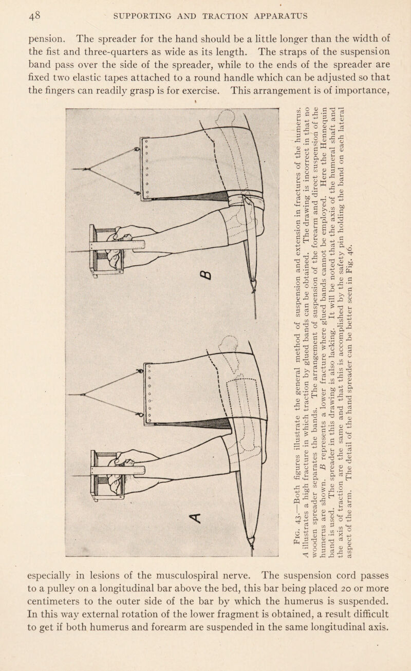 pension. The spreader for the hand should be a little longer than the width of the fist and three-quarters as wide as its length. The straps of the suspension band pass over the side of the spreader, while to the ends of the spreader are fixed two elastic tapes attached to a round handle which can be adjusted so that the fingers can readily grasp is for exercise. This arrangement is of importance, p <D 3 X 0) X P O P cO X P~ p O QJ X cu cu 2 xn d u d p o cO bO £.2 d p o3 u § x • rH d ^ § H -1-5 X „ 1 ^ rD D n a ^ d dx .2-0 M d d d X ft p xn d d cO w o . xn ■gi <2 X d d d bo 2 ^ Si X d _ d a d O bo (0 d p co X P -d> p W P d y c « d P 45 Sd oK ® p X rd '4-4 X o 0) >•.2 o x 'A co a^ d yi d JJ X CO -p ri o d X d d co -je u d xn w X d d X! ft _ xn X !> w ^d t—i s-i to o p p bi) d « d d X X a * d & d 2 bo u d d o cJ p « p od % cO co p w cO u d ■p‘ X d cO d d o X d cO X d X p bo d 2 2 x d • »-H a • x <2 t? 32 d d x • ^ d >, d d p4 xn d X H d X d ax -p c> xn d d W pH d d p -p d o bo d X 2 2 M ° X ? * L C/5 33 C/3 a aj D rd P C/3 D P aS u .aj Ch CD C/3 11 , Vh CO Tj xn -p d d xn d p ft d p cq d Z o X xn P d X cO d _ p p ft cO xn xn p d X cO d p ft xn d X H o 2 d d x o o 2 £ £ x <D C/3 3 C/3 C/3 2 U CD a d x X P d d X £ .52 d Tft'Q sjs o ^ o « a d 03 q .52 vh ^ CD _ r~! 03 T3 D P d ^ 03 C/3 rd rrj ^ d X d d X! cO d X d p> § O C/3 • rH 0) cO (“* -P X d ^ x d dj d o • T—< * p d d d d d P co d <p X o p * I I .2 o X p cO d d d X X W p cO especially in lesions of the musculospiral nerve. The suspension cord passes to a pulley on a longitudinal bar above the bed, this bar being placed 20 or more centimeters to the outer side of the bar by which the humerus is suspended. In this way external rotation of the lower fragment is obtained, a result difficult to get if both humerus and forearm are suspended in the same longitudinal axis.