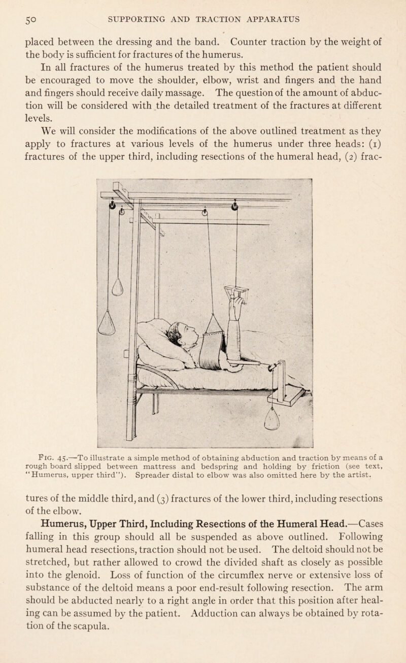 placed between the dressing and the band. Counter traction by the weight of the body is sufficient for fractures of the humerus. In all fractures of the humerus treated by this method the patient should be encouraged to move the shoulder, elbow, wrist and fingers and the hand and fingers should receive daily massage. The question of the amount of abduc¬ tion will be considered with the detailed treatment of the fractures at different levels. We will consider the modifications of the above outlined treatment as they apply to fractures at various levels of the humerus under three heads: (i) fractures of the upper third, including resections of the humeral head, (2) frac- Fig. 45.—To illustrate a simple method of obtaining abduction and traction by means of a rough board slipped between mattress and bedspring and holding by friction (see text, “Humerus, upper third”). Spreader distal to elbow was also omitted here by the artist. tures of the middle third, and (3) fractures of the lower third, including resections of the elbow. Humerus, Upper Third, Including Resections of the Humeral Head.—Cases falling in this group should all be suspended as above outlined. Following humeral head resections, traction should not be used. The deltoid should not be stretched, but rather allowed to crowd the divided shaft as closely as possible into the glenoid. Loss of function of the circumflex nerve or extensive loss of substance of the deltoid means a poor end-result following resection. The arm should be abducted nearly to a right angle in order that this position after heal¬ ing can be assumed by the patient. Adduction can always be obtained by rota¬ tion of the scapula.