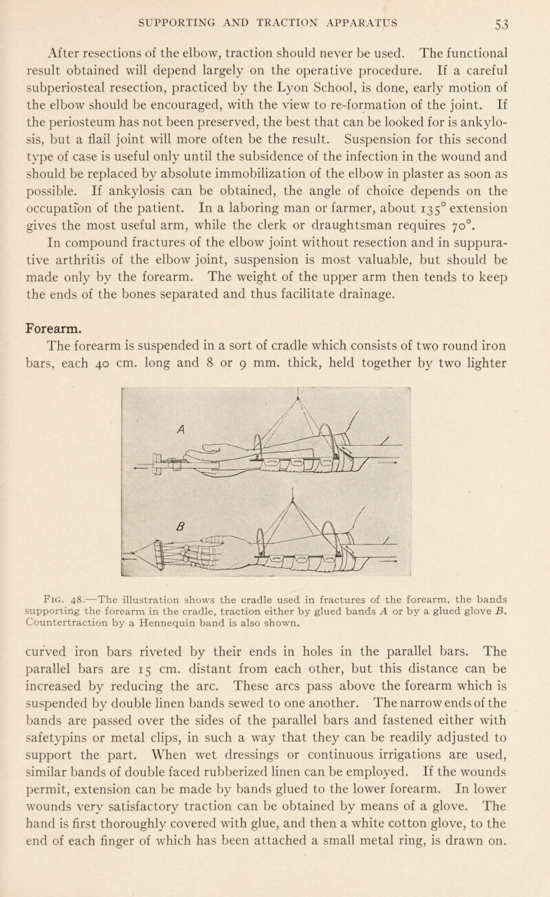 After resections of the elbow, traction should never be used. The functional result obtained will depend largely on the operative procedure. If a careful subperiosteal resection, practiced by the Lyon School, is done, early motion of the elbow should be encouraged, with the view to re-formation of the joint. If the periosteum has not been preserved, the best that can be looked for is ankylo¬ sis, but a flail joint will more often be the result. Suspension for this second type of case is useful only until the subsidence of the infection in the wound and should be replaced by absolute immobilization of the elbow in plaster as soon as possible. If ankylosis can be obtained, the angle of choice depends on the occupation of the patient. In a laboring man or farmer, about 1350 extension gives the most useful arm, while the clerk or draughtsman requires 70°. In compound fractures of the elbow joint without resection and in suppura¬ tive arthritis of the elbow joint, suspension is most valuable, but should be made only by the forearm. The weight of the upper arm then tends to keep the ends of the bones separated and thus facilitate drainage. Forearm. The forearm is suspended in a sort of cradle which consists of two round iron bars, each 40 cm. long and 8 or 9 mm. thick, held together by two lighter Fig. 48.—The illustration shows the cradle used in fractures of the forearm, the bands supporting the forearm in the cradle, traction either by glued bands A or by a glued glove B. Countertraction by a Hennequin band is also shown. curved iron bars riveted by their ends in holes in the parallel bars. The parallel bars are 15 cm. distant from each other, but this distance can be increased by reducing the arc. These arcs pass above the forearm which is suspended by double linen bands sewed to one another. The narrow ends of the bands are passed over the sides of the parallel bars and fastened either with safetypins or metal clips, in such a way that they can be readily adjusted to support the part. When wet dressings or continuous irrigations are used, similar bands of double faced rubberized linen can be employed. If the wounds permit, extension can be made by bands glued to the lower forearm. In lower wounds very satisfactory traction can be obtained by means of a glove. The hand is first thoroughly covered with glue, and then a white cotton glove, to the end of each finger of which has been attached a small metal ring, is drawn on.
