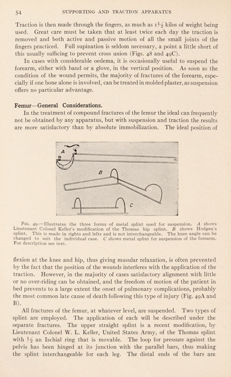 Traction is then made through the fingers, as much as i4^ kilos of weight being used. Great care must be taken that at least twice each day the traction is removed and both active and passive motion of all the small joints of the fingers practiced. Full supination is seldom necessary, a point a little short of this usually sufficing to prevent cross union (Figs. 48 and 49C). In cases with considerable oedema, it is occasionally useful to suspend the forearm, either with band or a glove, in the vertical position. As soon as the condition of the wound permits, the majority of fractures of the forearm, espe¬ cially if one bone alone is involved, can be treated in molded plaster, as suspension offers no particular advantage. Femur™-General Considerations. In the treatment of compound fractures of the femur the ideal can frequently not be obtained by any apparatus, but with suspension and traction the results are more satisfactory than by absolute immobilization. The ideal position of Fig. 49.—Illustrates the three forms of metal splint used for suspension. A shows Lieutenant Colonel Keller’s modification of the Thomas hip splint. B shows Hodgen’s splint. This is made in rights and lefts and is not interchangeable. The knee angle can be changed to suit the individual case. C shows metal splint for suspension of the forearm. For description see text. flexion at the knee and hip, thus giving musular relaxation, is often prevented by the fact that the position of the wounds interferes with the application of the traction. However, in the majority of cases satisfactory alignment with little or no over-riding can be obtained, and the freedom of motion of the patient in bed prevents to a large extent the onset of pulmonary complications, probably the most common late cause of death following this type of injury (Fig. 49A and B). All fractures of the femur, at whatever level, are suspended. Two types of splint are employed. The application of each will be described under the separate fractures. The upper straight splint is a recent modification, by Lieutenant Colonel W. L. Keller, United States Army, of the Thomas splint with ^2 an Ischial ring that is movable. The loop for pressure against the pelvis has been hinged at its junction with the parallel bars, thus making the splint interchangeable for each leg. The distal ends of the bars are
