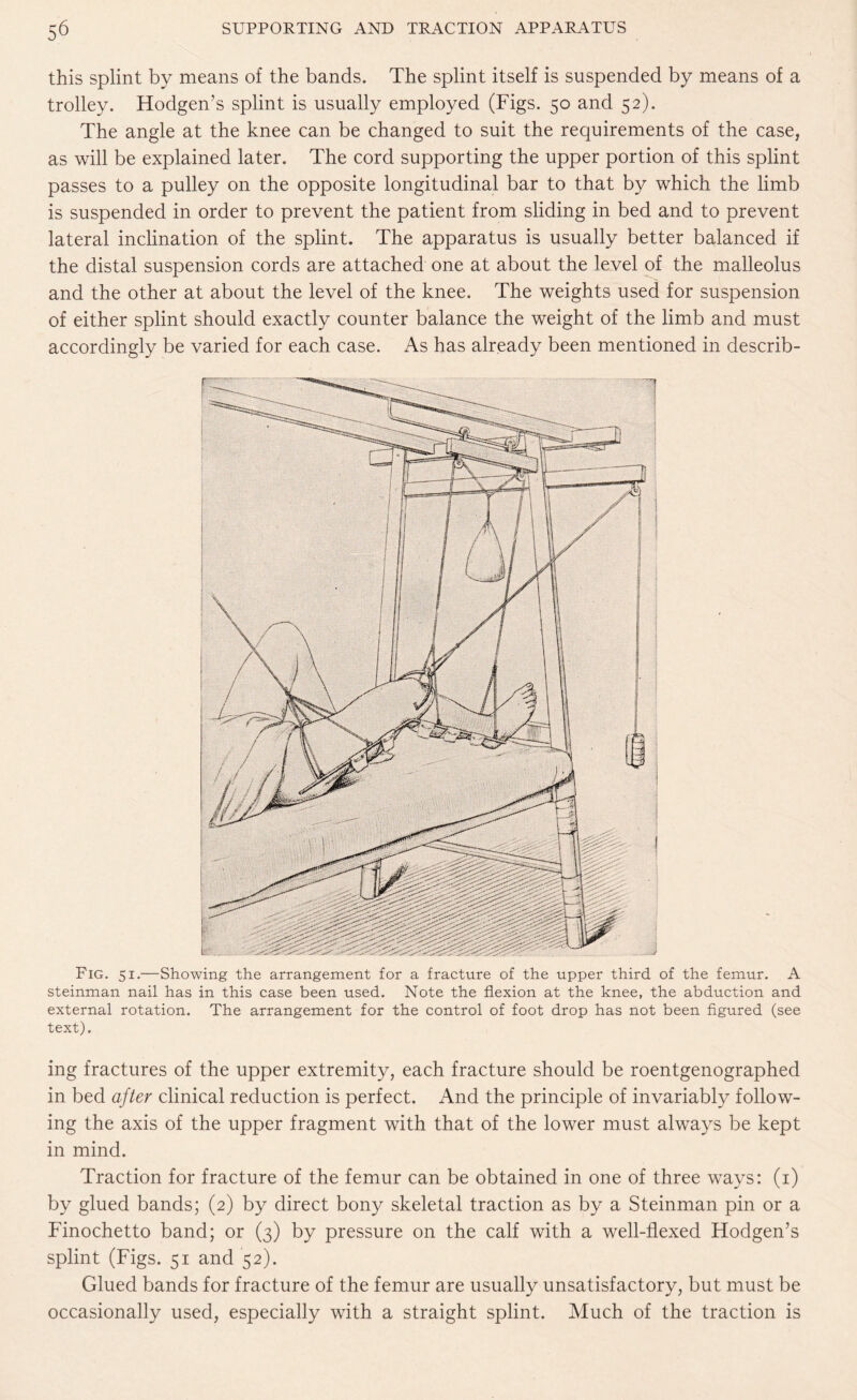 this splint by means of the bands. The splint itself is suspended by means of a trolley. Hodgen’s splint is usually employed (Figs. 50 and 52). The angle at the knee can be changed to suit the requirements of the case, as will be explained later. The cord supporting the upper portion of this splint passes to a pulley on the opposite longitudinal bar to that by which the limb is suspended in order to prevent the patient from sliding in bed and to prevent lateral inclination of the splint. The apparatus is usually better balanced if the distal suspension cords are attached one at about the level of the malleolus and the other at about the level of the knee. The weights used for suspension of either splint should exactly counter balance the weight of the limb and must accordingly be varied for each case. As has already been mentioned in describ- Fig. 51.—Showing the arrangement for a fracture of the upper third of the femur. A steinman nail has in this case been used. Note the flexion at the knee, the abduction and external rotation. The arrangement for the control of foot drop has not been figured (see text). ing fractures of the upper extremity, each fracture should be roentgenographed in bed after clinical reduction is perfect. And the principle of invariably follow¬ ing the axis of the upper fragment with that of the lower must always be kept in mind. Traction for fracture of the femur can be obtained in one of three ways: (1) by glued bands; (2) by direct bony skeletal traction as by a Steinman pin or a Finochetto band; or (3) by pressure on the calf with a well-flexed Hodgen’s splint (Figs. 51 and 52). Glued bands for fracture of the femur are usually unsatisfactory, but must be occasionally used, especially with a straight splint. Much of the traction is