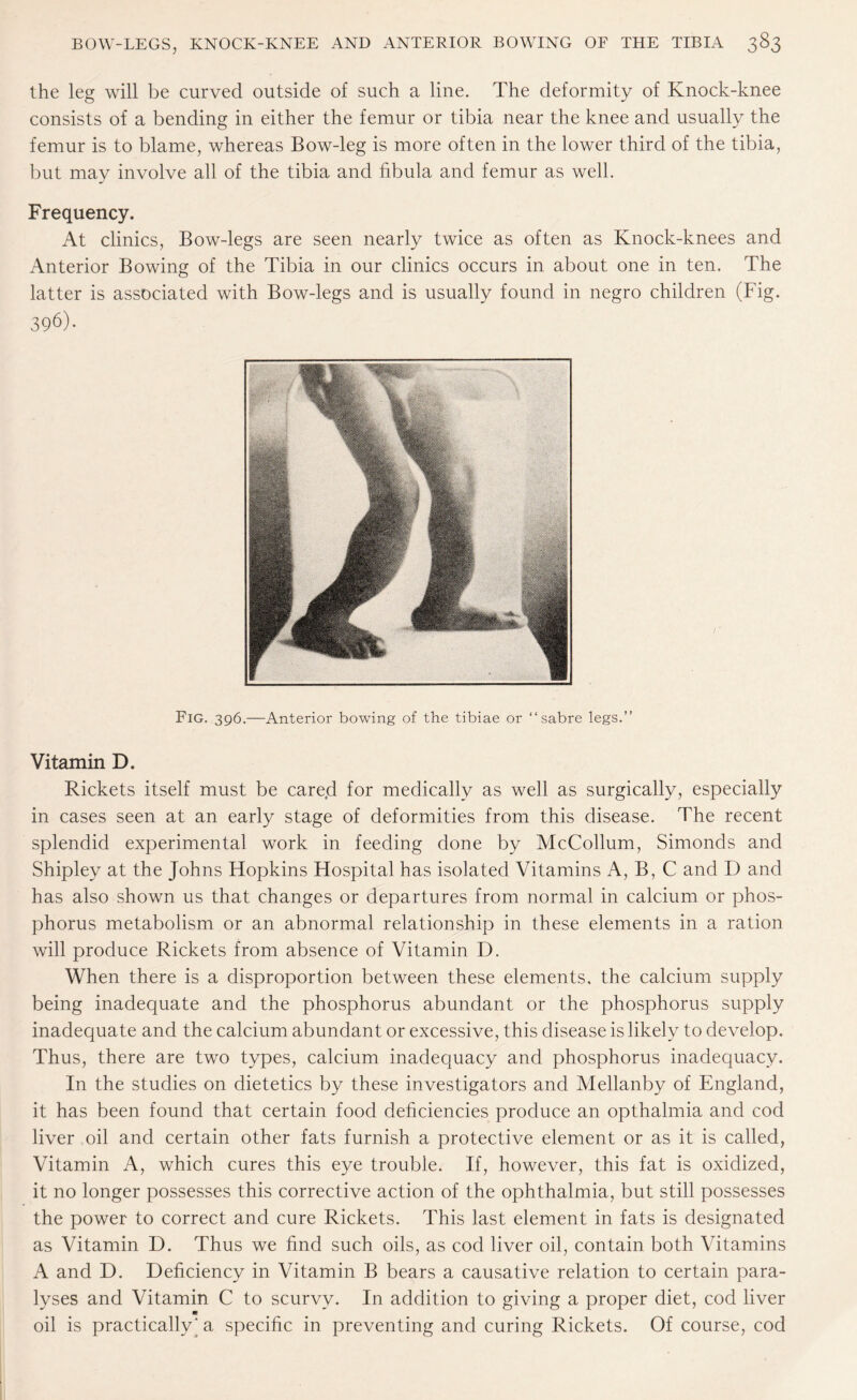 the leg will be curved outside of such a line. The deformity of Knock-knee consists of a bending in either the femur or tibia near the knee and usually the femur is to blame, whereas Bow-leg is more often in the lower third of the tibia, but may involve all of the tibia and fibula and femur as well. Frequency. At clinics, Bow-legs are seen nearly twice as often as Knock-knees and Anterior Bowing of the Tibia in our clinics occurs in about one in ten. The latter is associated with Bow-legs and is usually found in negro children (Fig. 396)- Fig. 396.—Anterior bowing of the tibiae or “sabre legs.” Vitamin D. Rickets itself must be care.d for medically as well as surgically, especially in cases seen at an early stage of deformities from this disease. The recent splendid experimental work in feeding done by McCollum, Simonds and Shipley at the Johns Hopkins Hospital has isolated Vitamins A, B, C and D and has also shown us that changes or departures from normal in calcium or phos¬ phorus metabolism or an abnormal relationship in these dements in a ration will produce Rickets from absence of Vitamin D. When there is a disproportion between these elements, the calcium supply being inadequate and the phosphorus abundant or the phosphorus supply inadequate and the calcium abundant or excessive, this disease is likely to develop. Thus, there are two types, calcium inadequacy and phosphorus inadequacy. In the studies on dietetics by these investigators and Mellanby of England, it has been found that certain food deficiencies produce an opthalmia and cod liver oil and certain other fats furnish a protective element or as it is called, Vitamin A, which cures this eye trouble. If, however, this fat is oxidized, it no longer possesses this corrective action of the ophthalmia, but still possesses the power to correct and cure Rickets. This last element in fats is designated as Vitamin D. Thus we find such oils, as cod liver oil, contain both Vitamins A and D. Deficiency in Vitamin B bears a causative relation to certain para¬ lyses and Vitamin C to scurvy. In addition to giving a proper diet, cod liver oil is practically'a specific in preventing and curing Rickets. Of course, cod